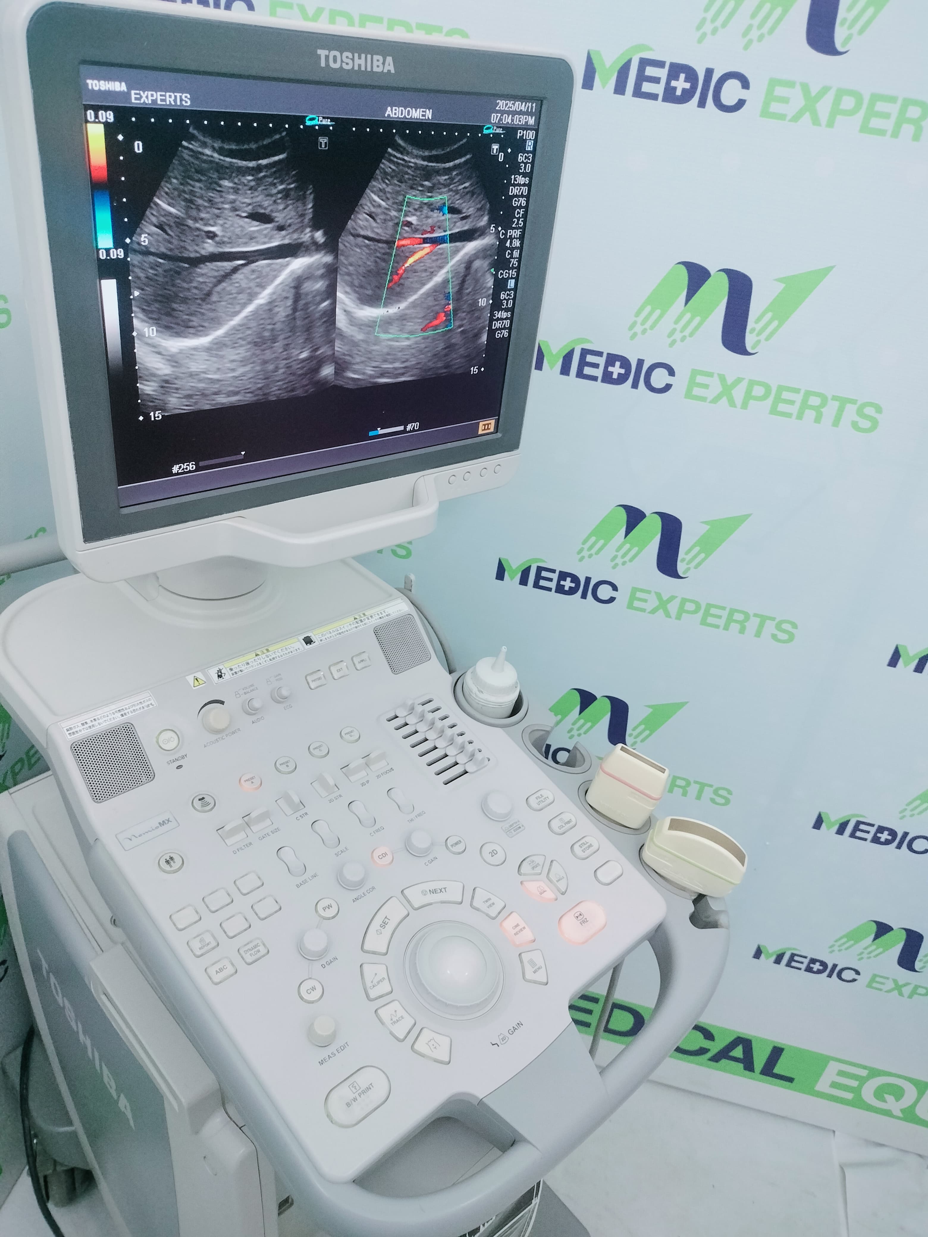 Toshiba Nemio MX with Convex and Linear Probes Roughly