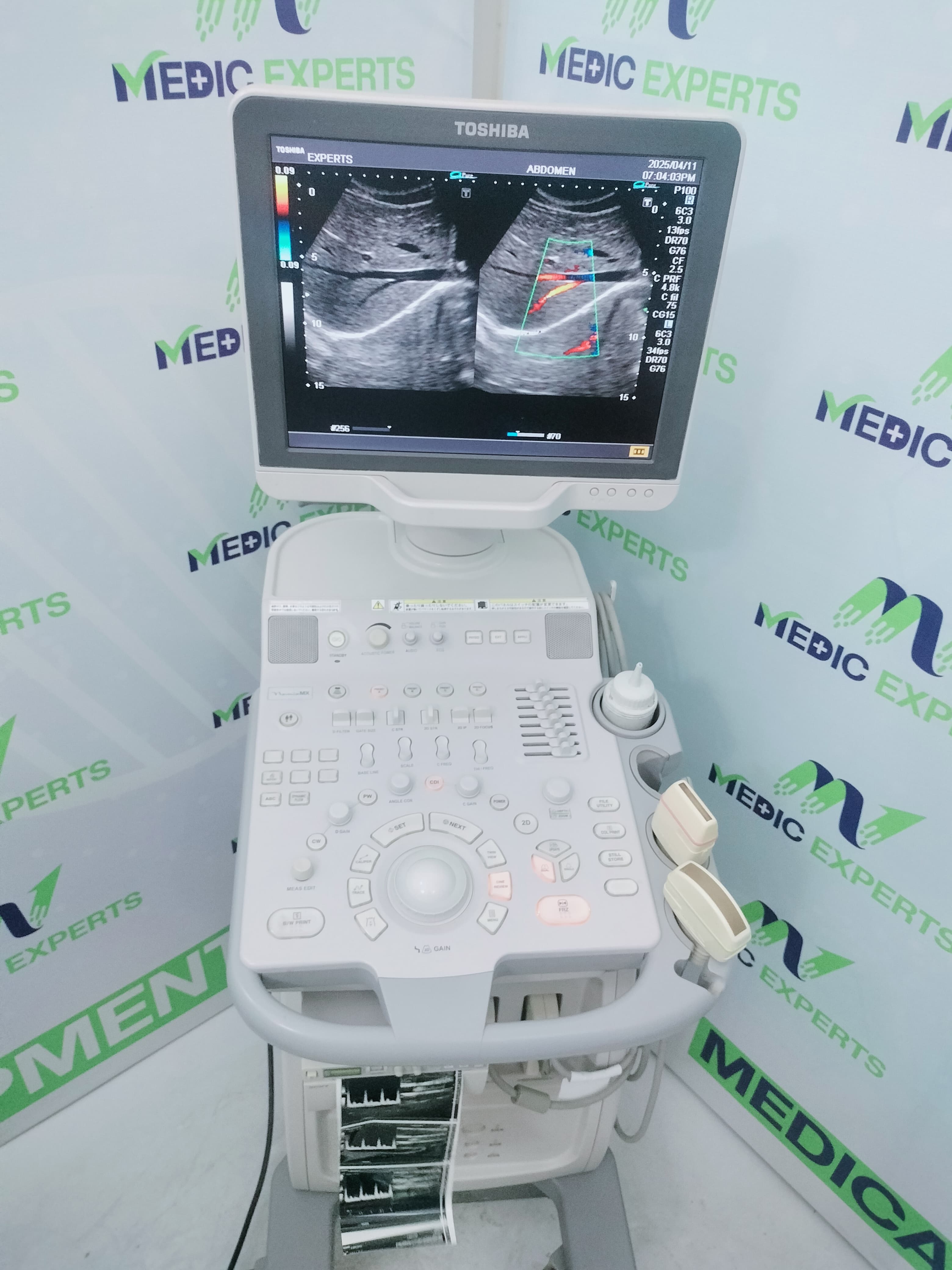 Toshiba Nemio MX with Convex and Linear Probes Roughly