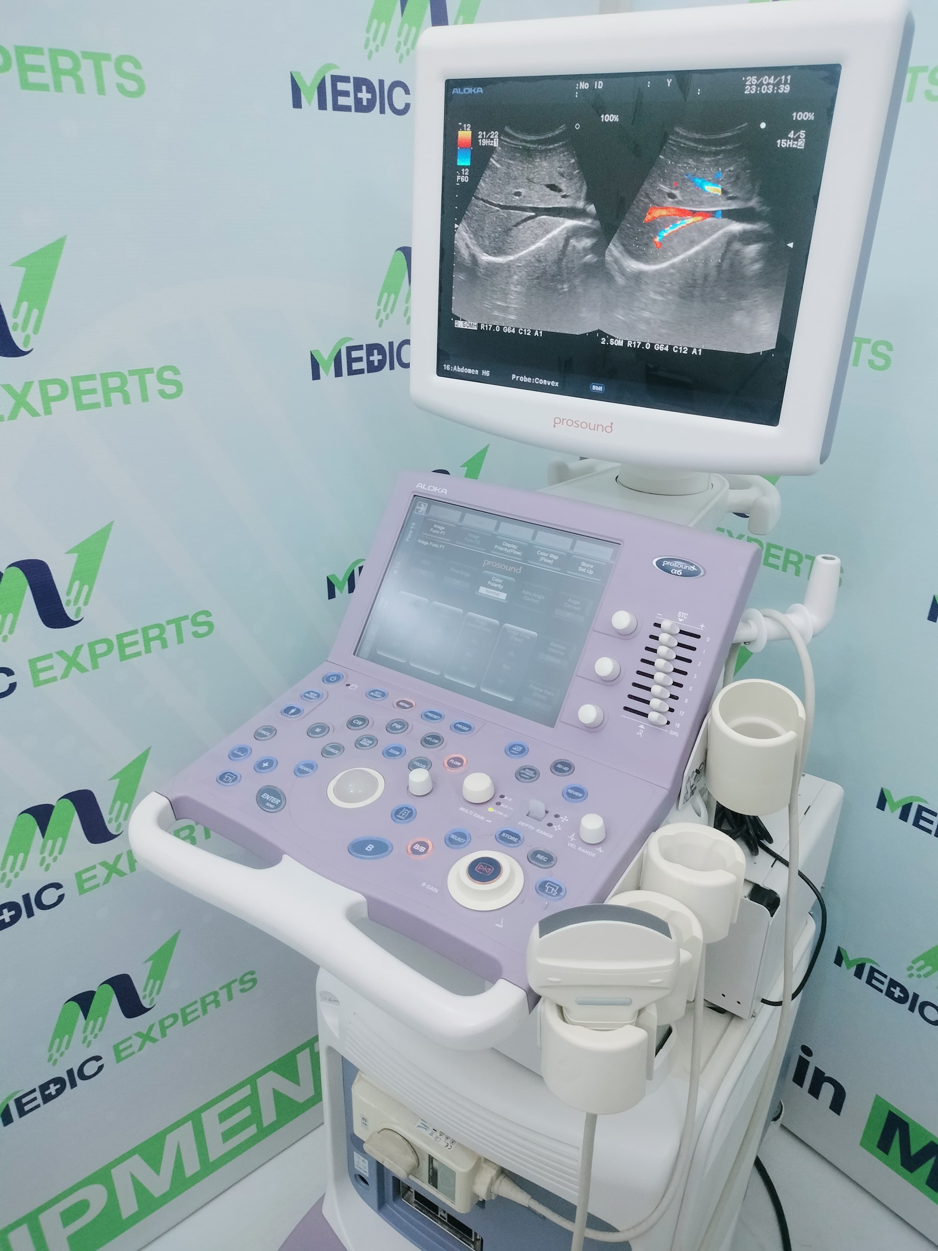 Aloka Alpha 6 with Convex Probe