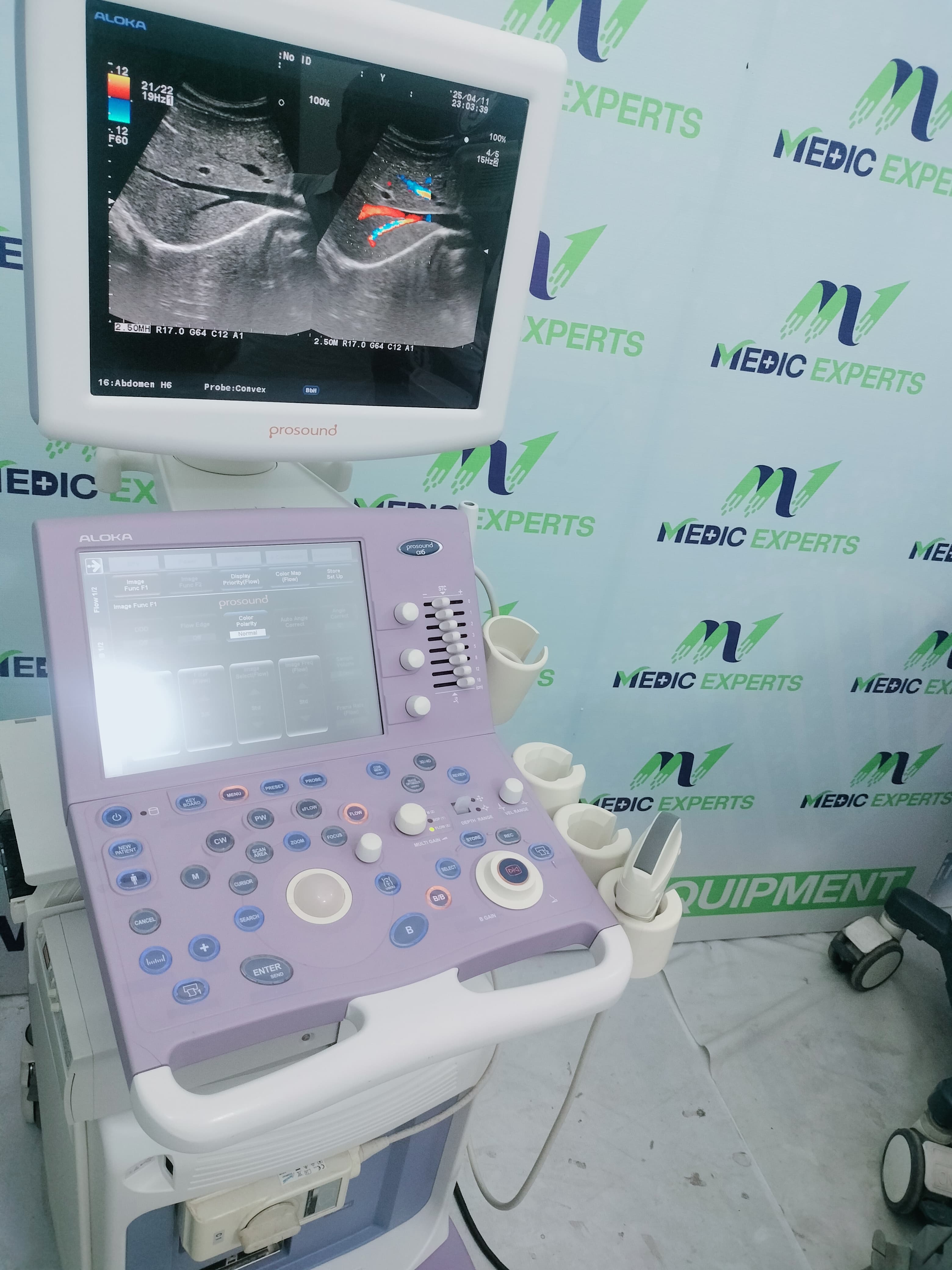 Aloka Alpha 6 with Convex Probe