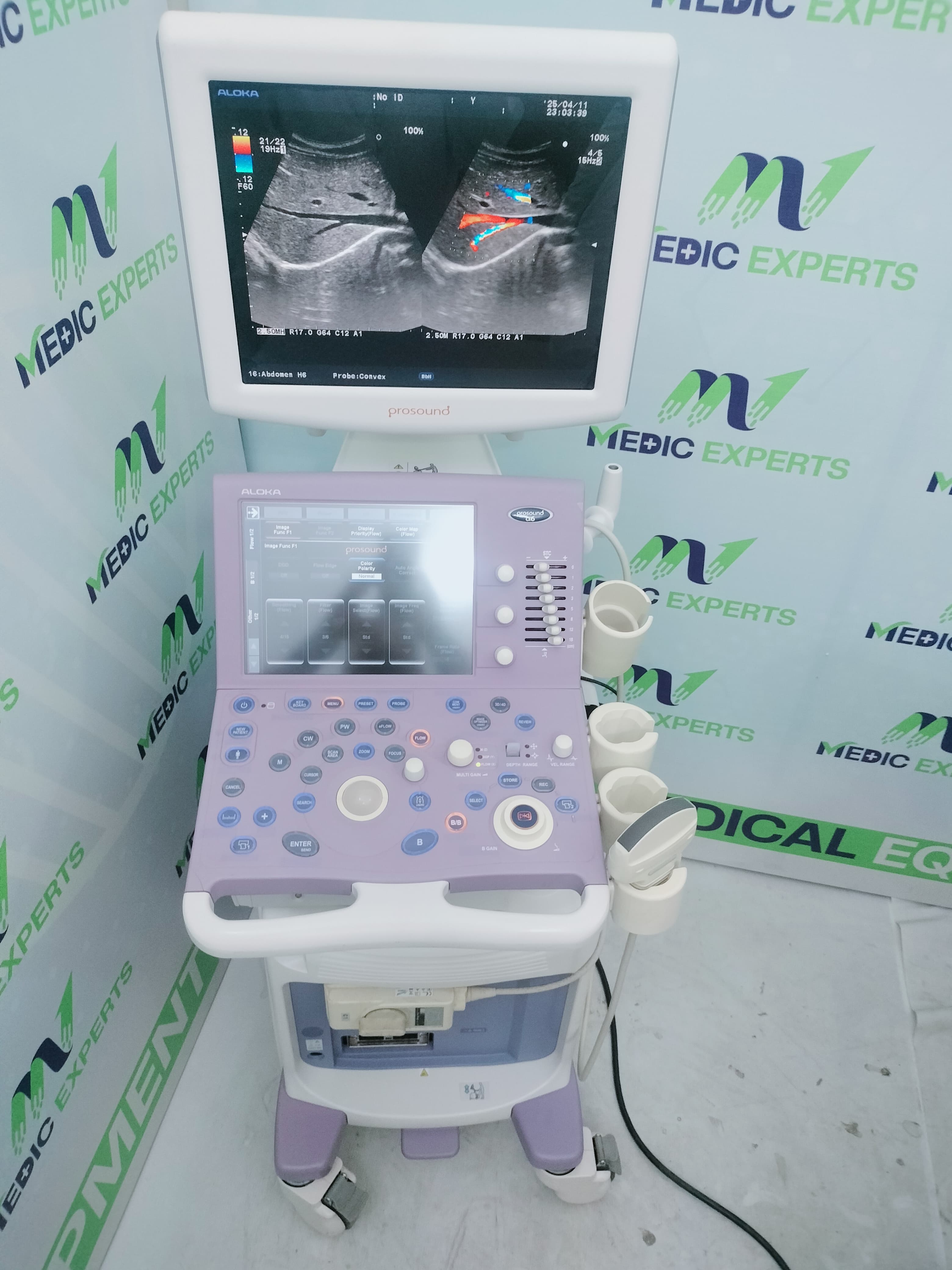 Aloka Alpha 6 with Convex Probe