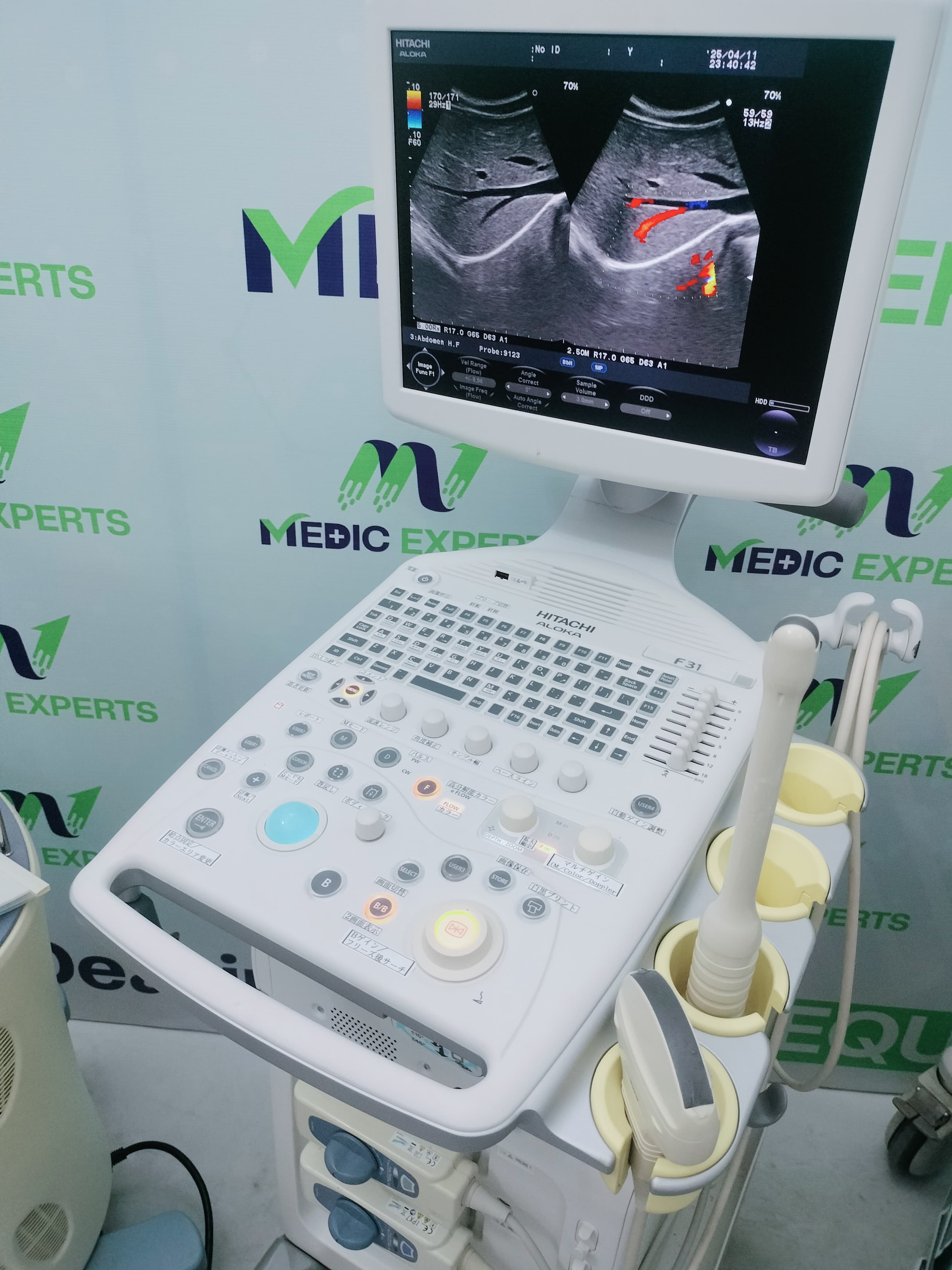 Hitachi F31 with Convex and TVS Probes