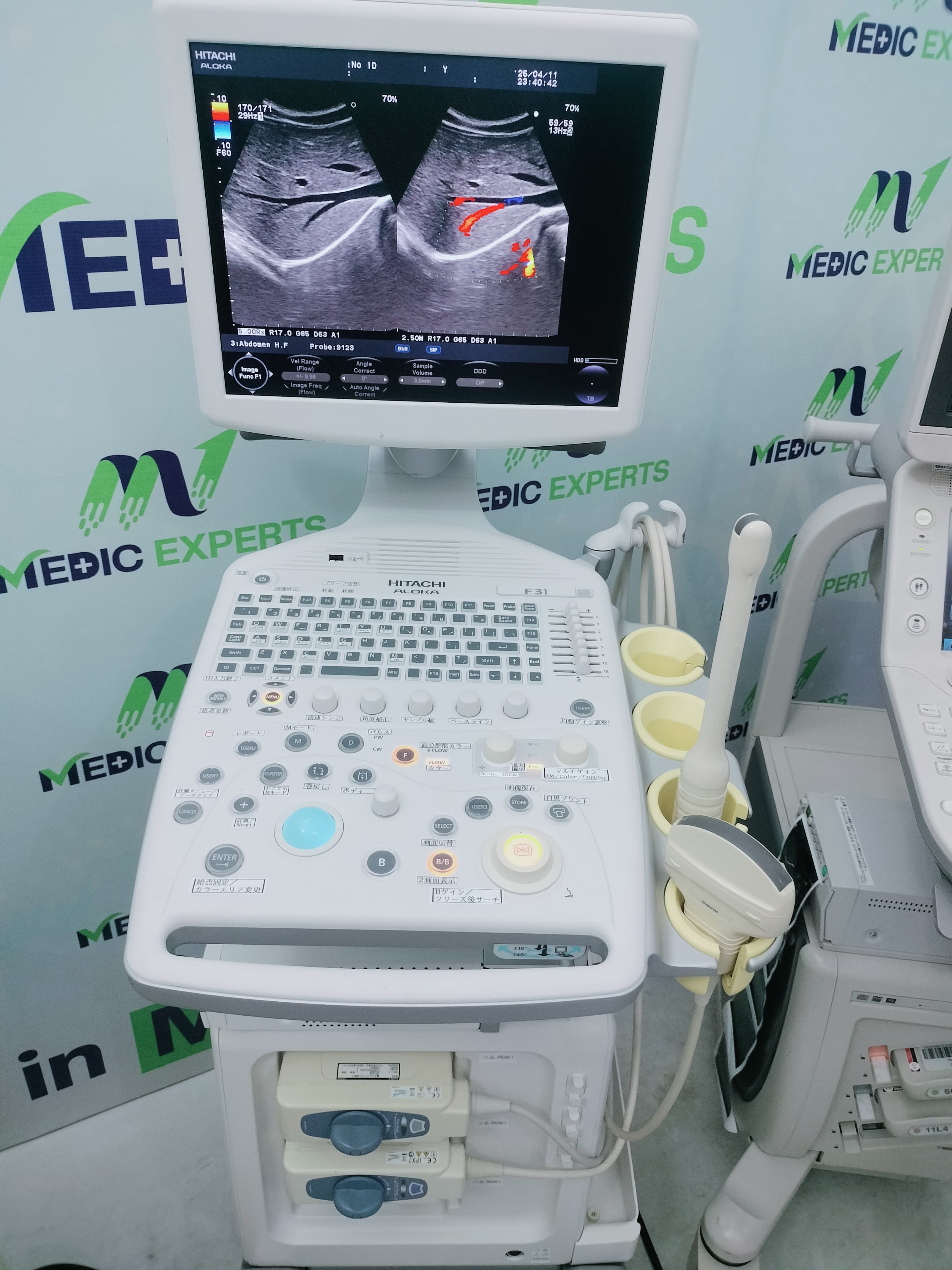 Hitachi F31 with Convex and TVS Probes