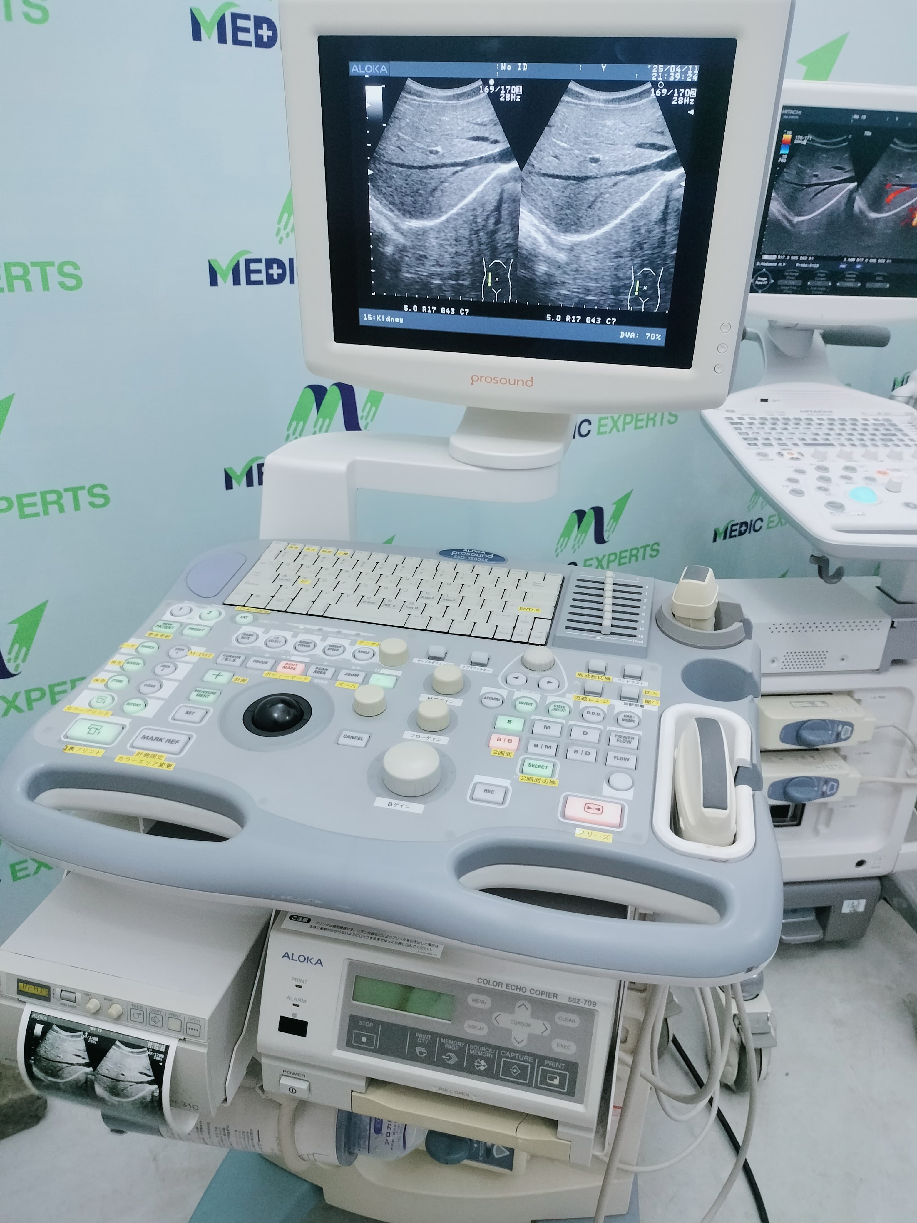Aloka SSD 3500SX LCD Based Color Doppler with Convex Probe