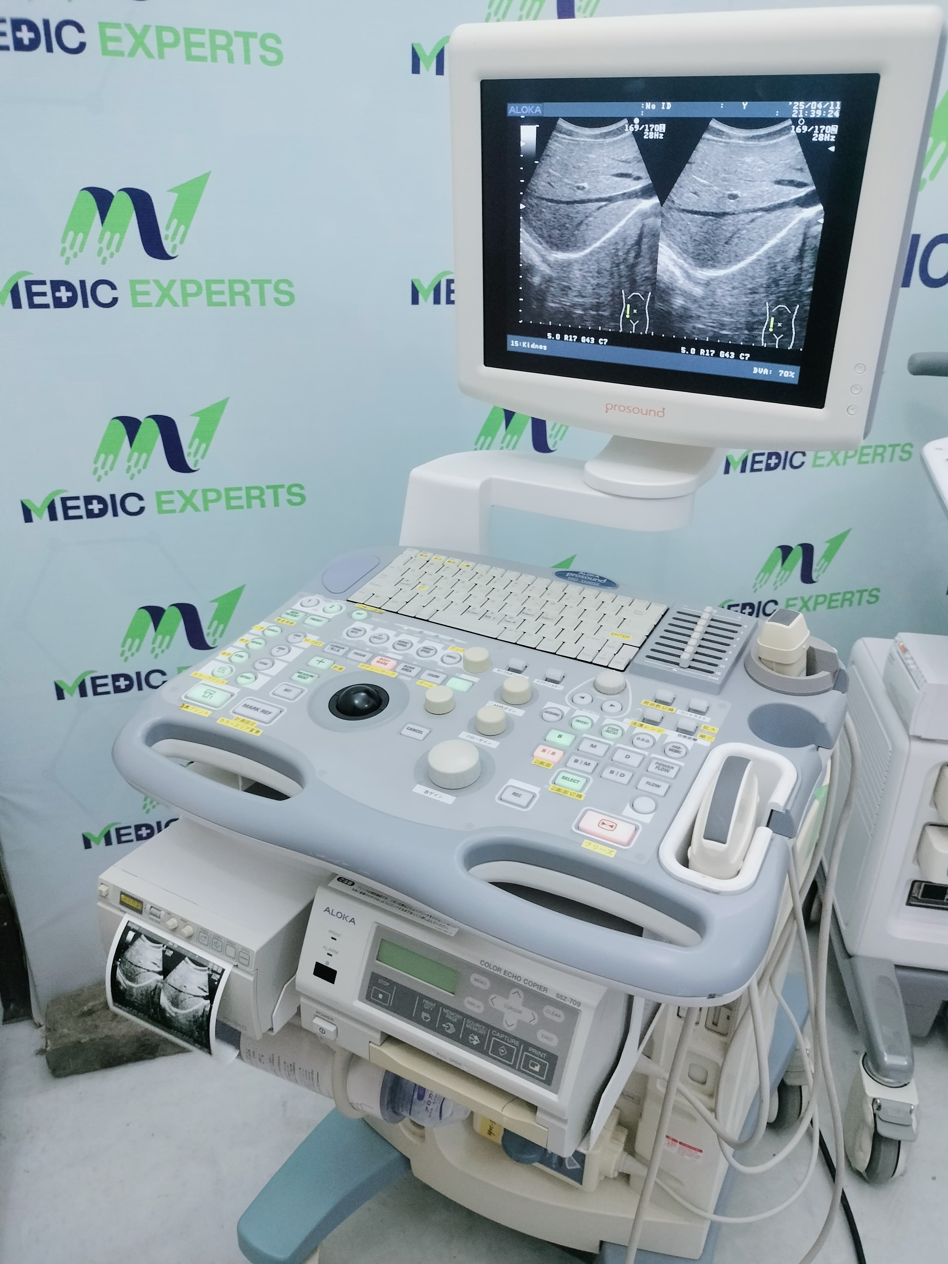Aloka SSD 3500SX LCD Based Color Doppler with Convex Probe