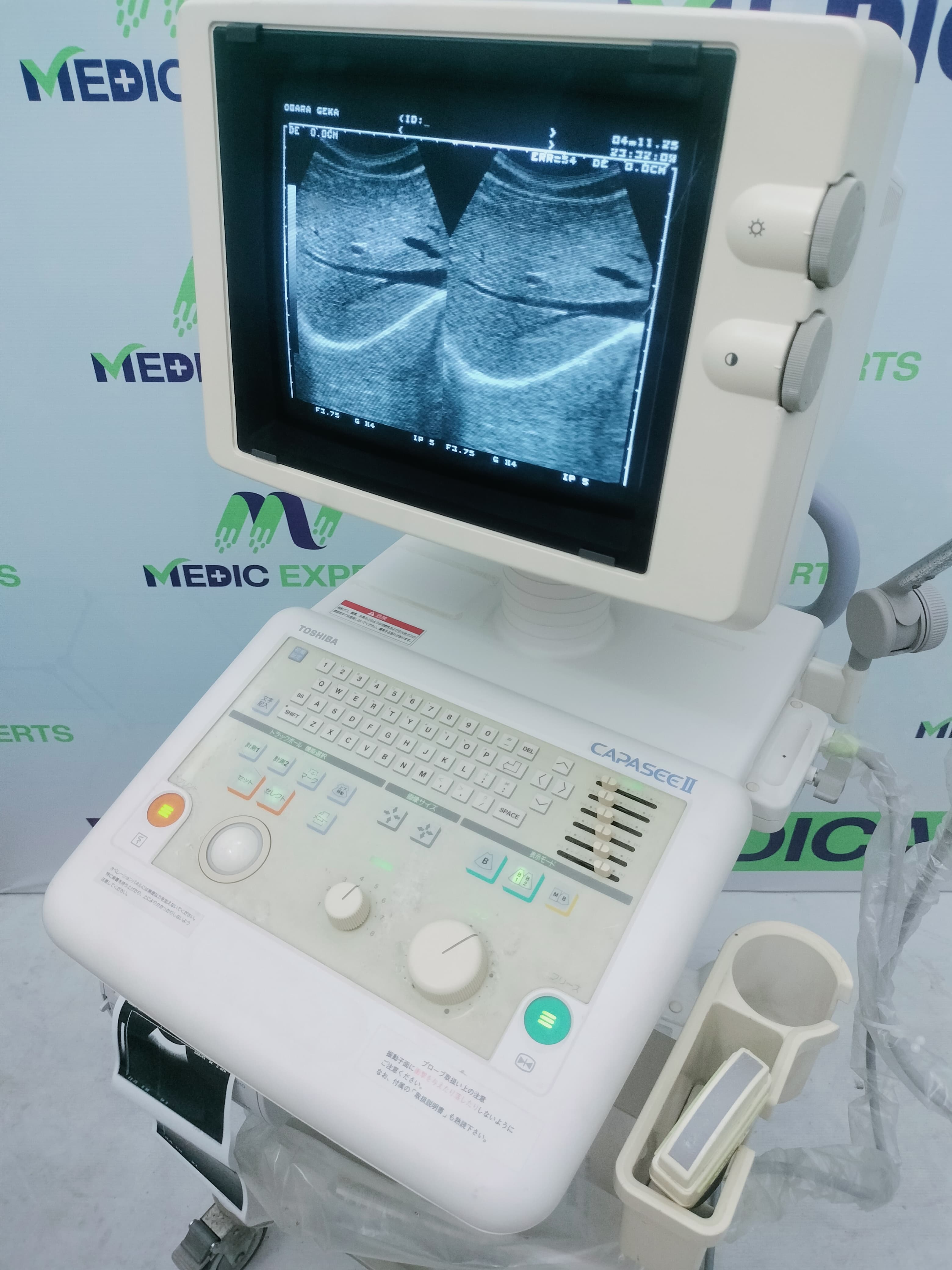 Toshiba Capassi 2 with Convex Probe