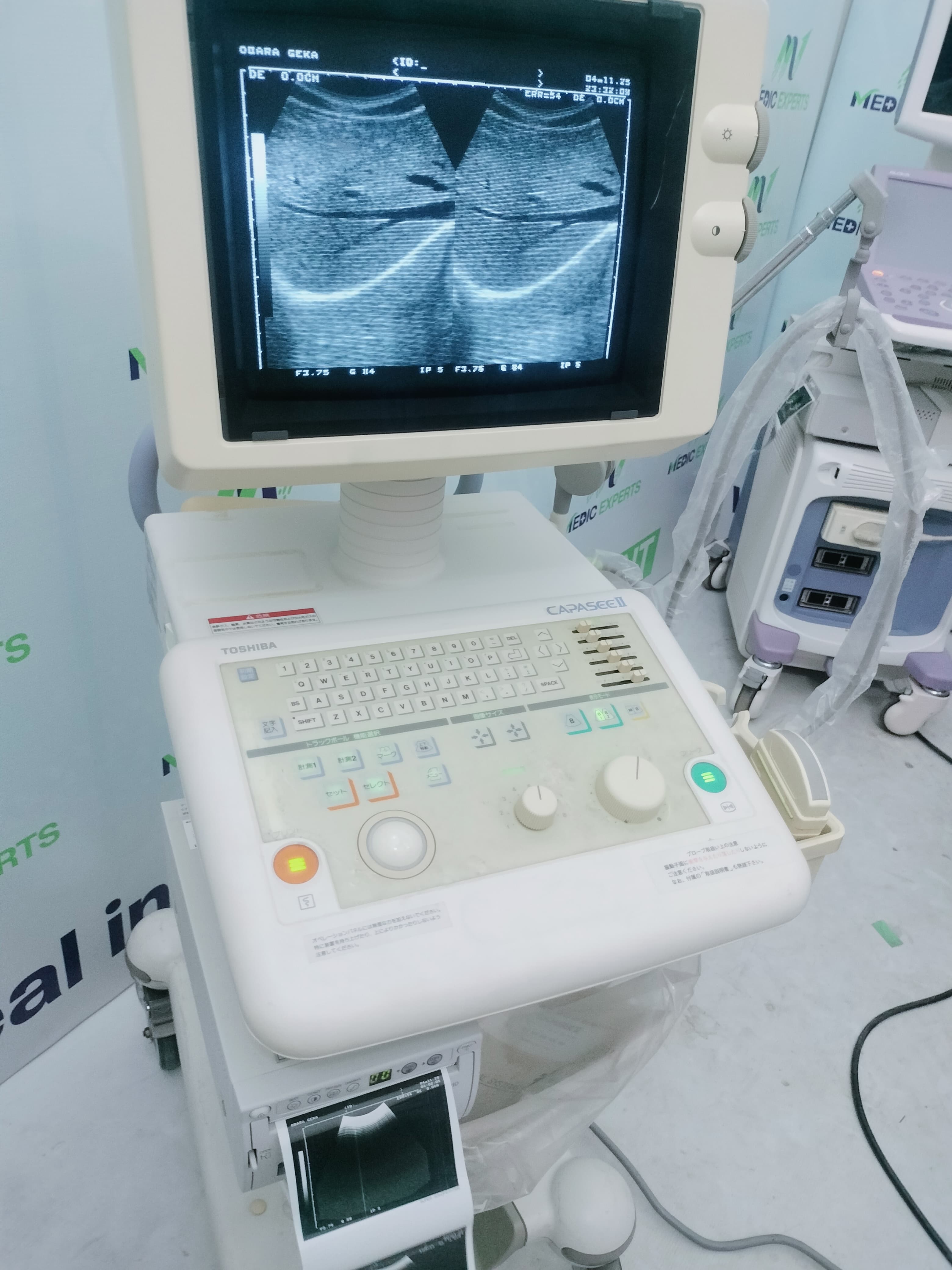 Toshiba Capassi 2 with Convex Probe
