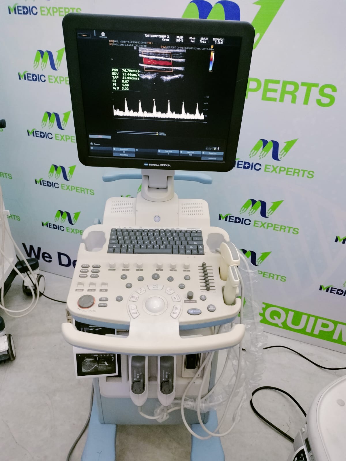 Medison R6 with Convex and Linear Probes