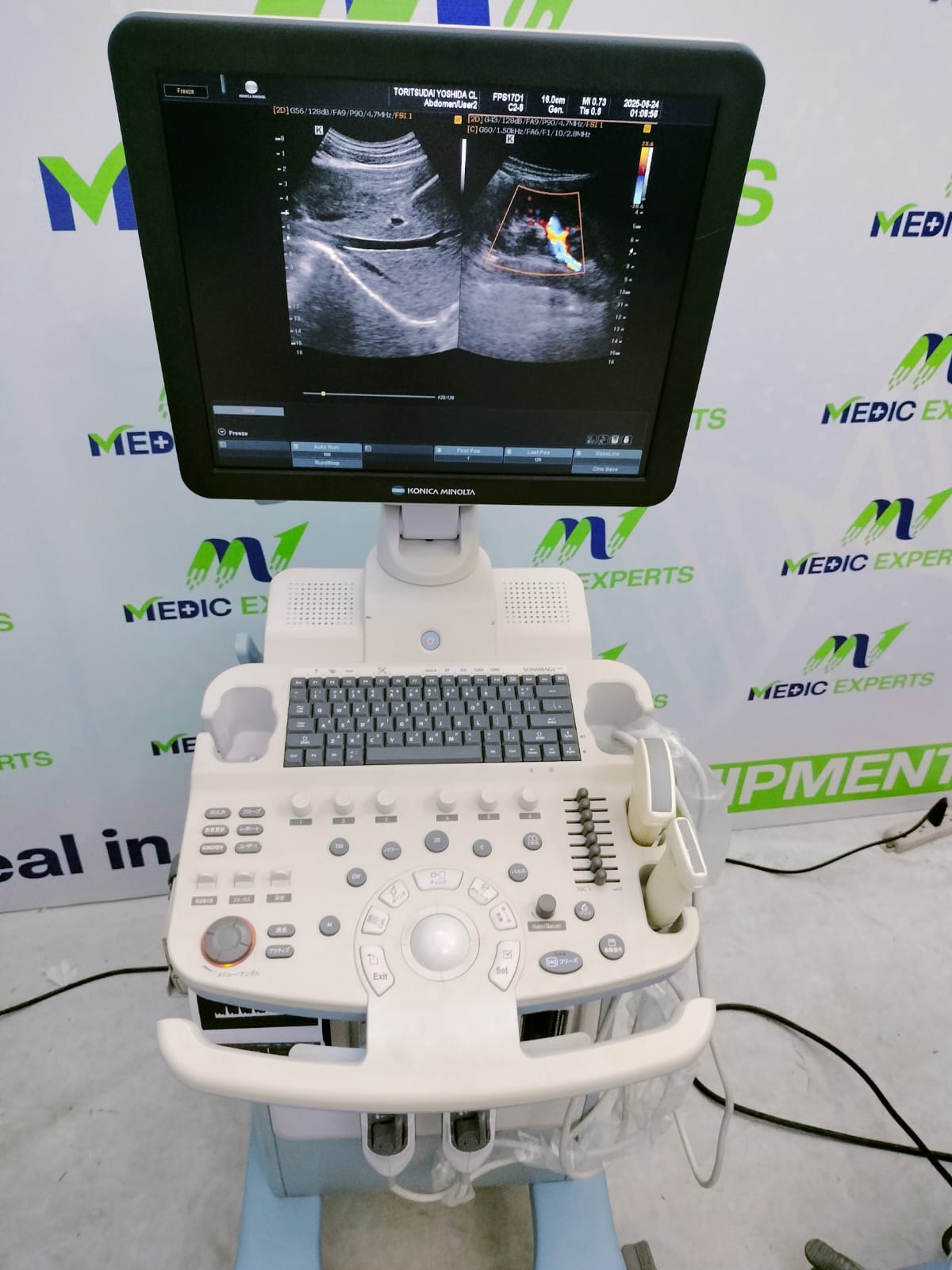 Medison R6 with Convex and Linear Probes