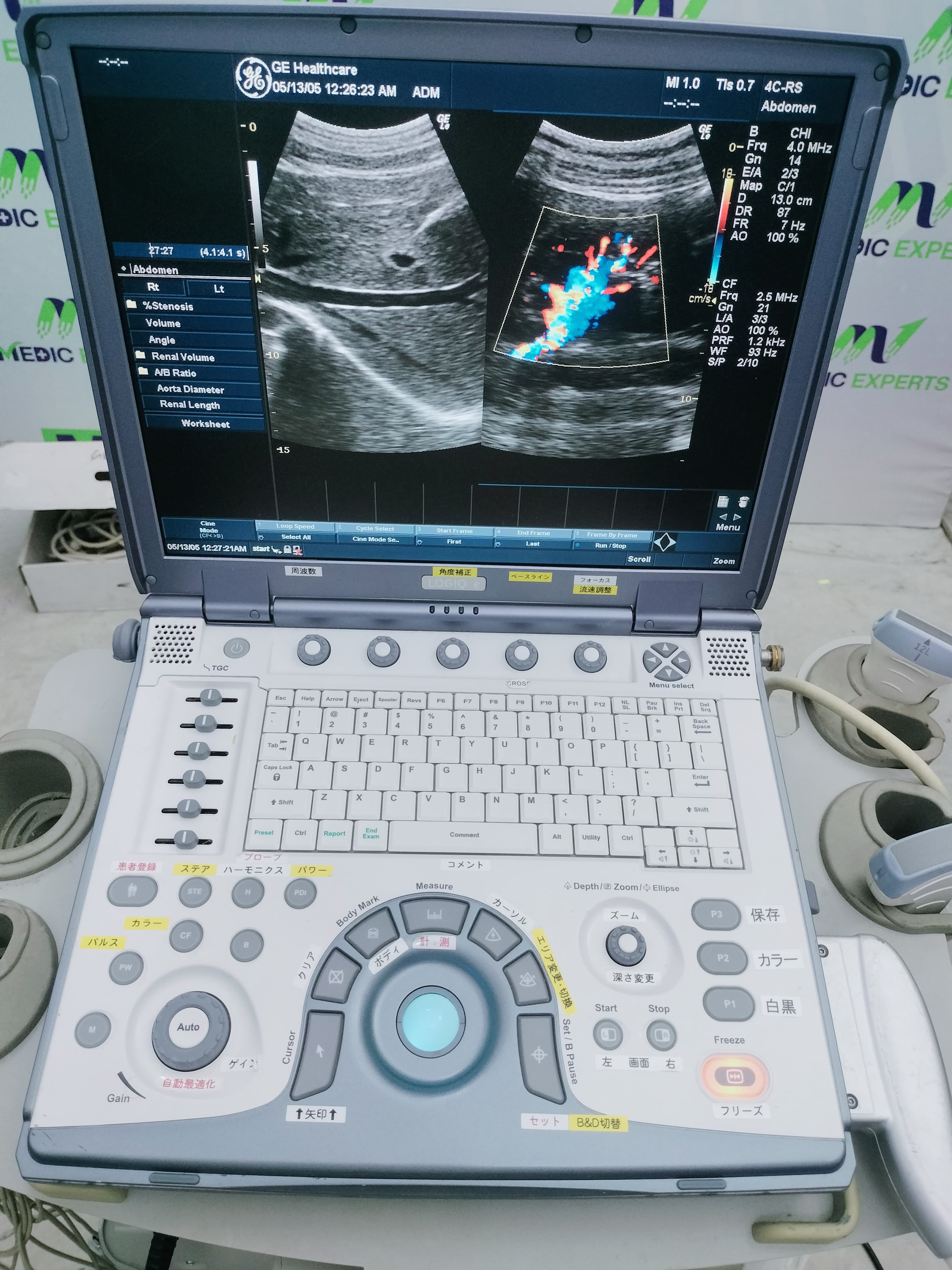 GE Portable Echo and Color Doppler Available in Any Configuration