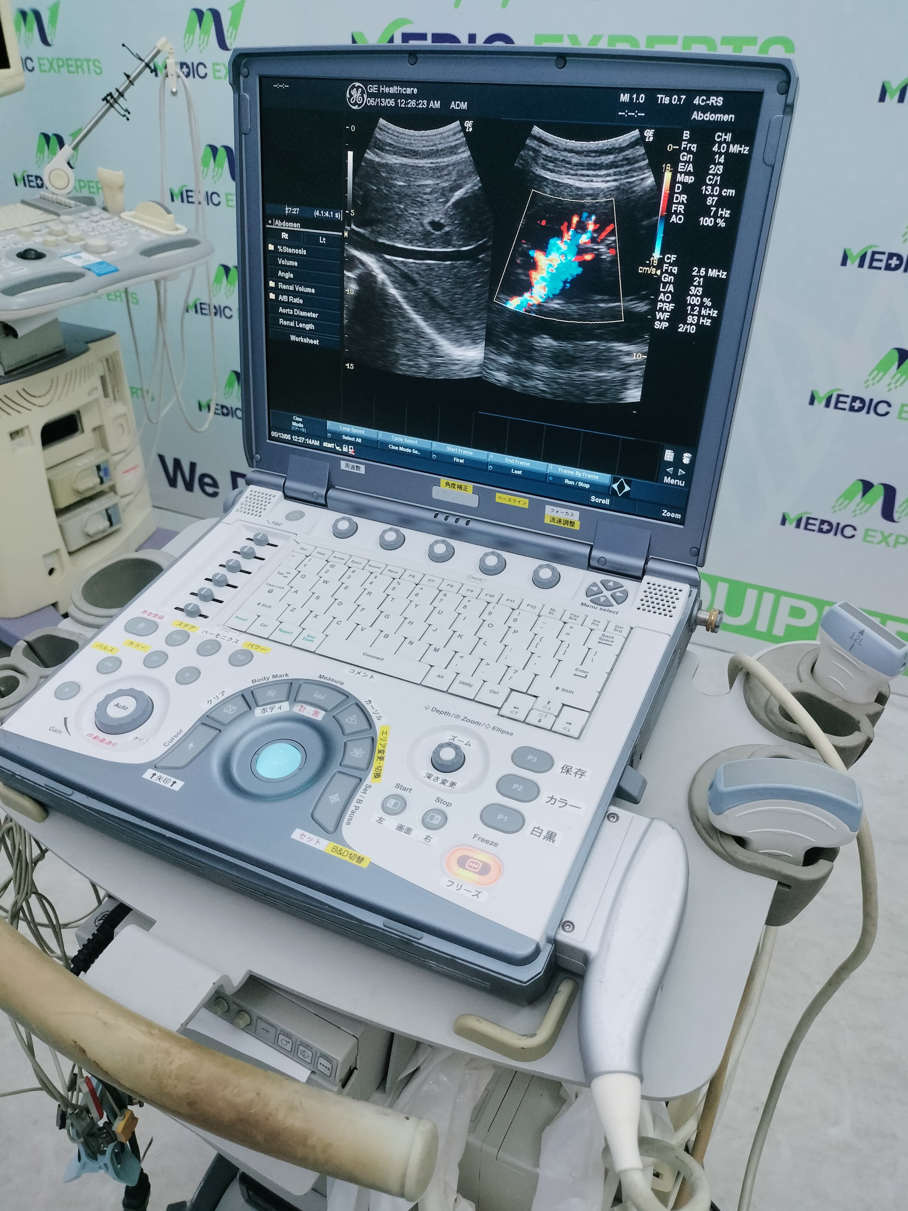 GE Portable Echo and Color Doppler Available in Any Configuration