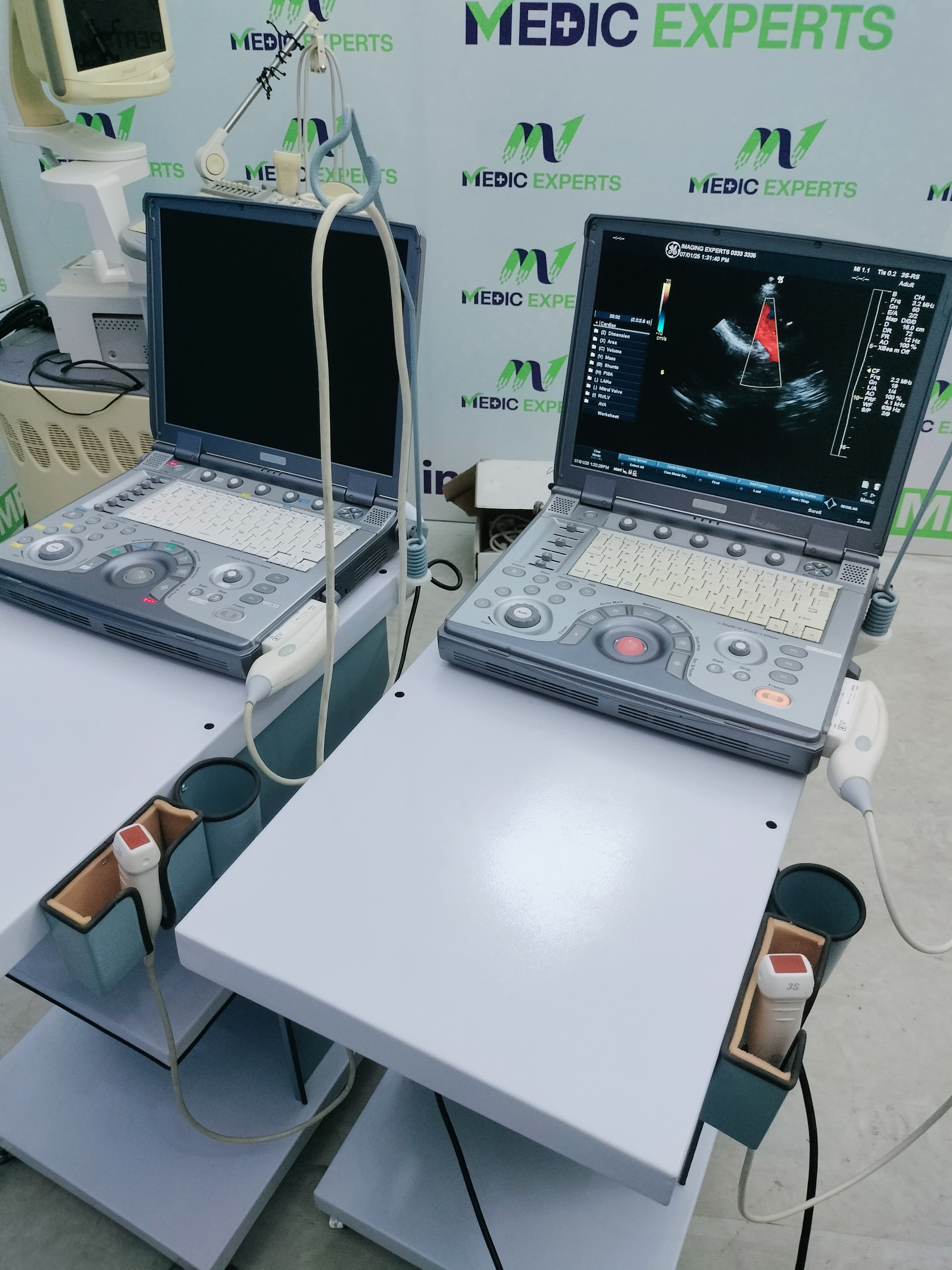 GE Portable Echo and Color Doppler Available in Any Configuration