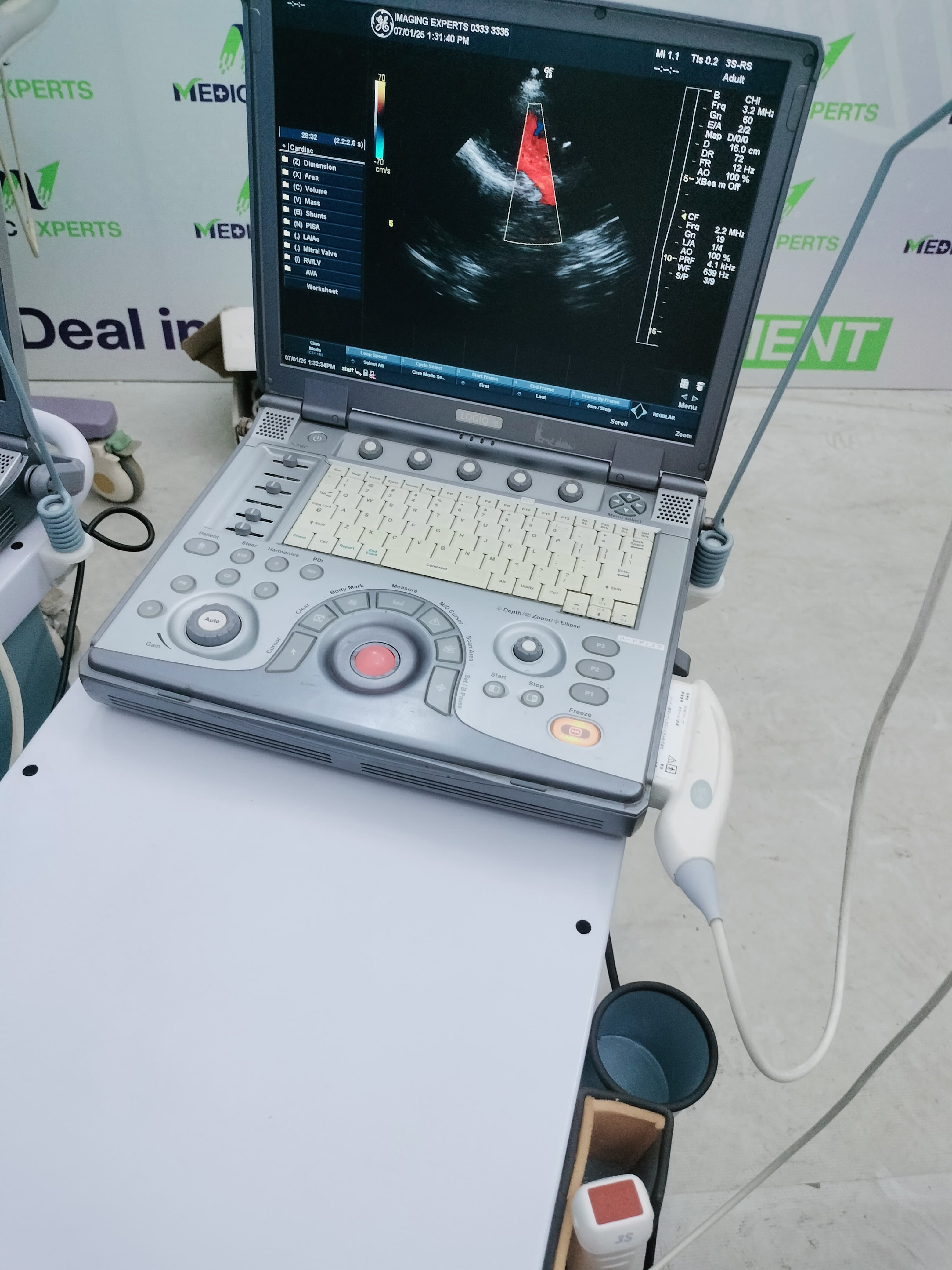 GE Portable Echo and Color Doppler Available in Any Configuration