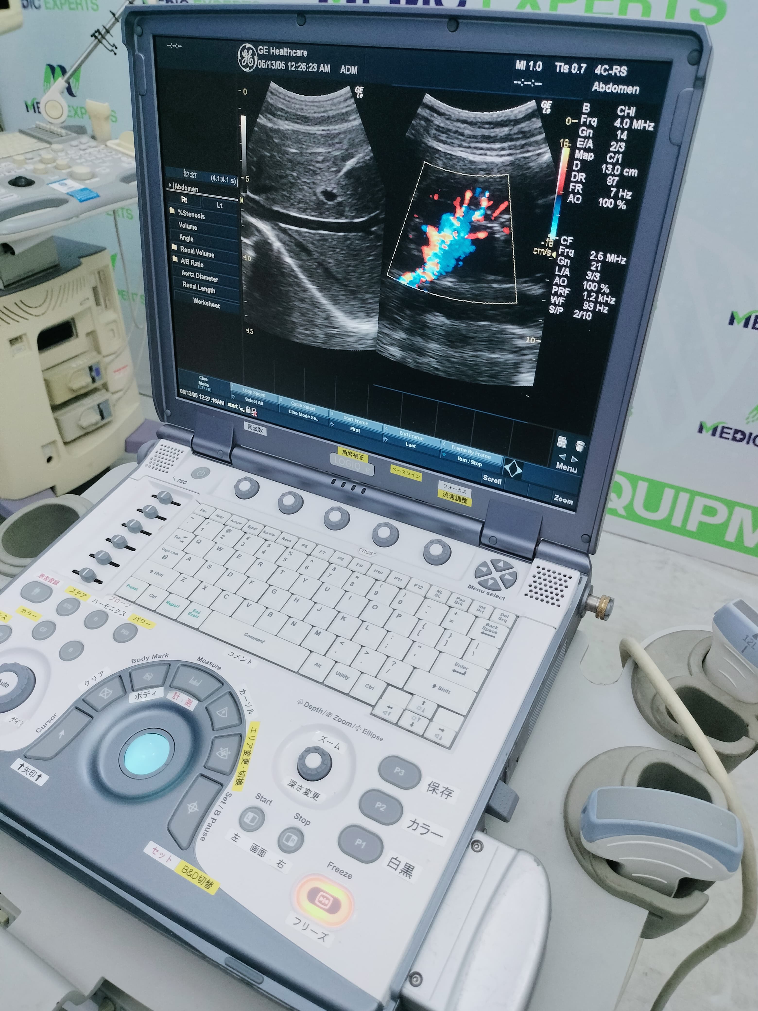 GE Portable Echo and Color Doppler Available in Any Configuration