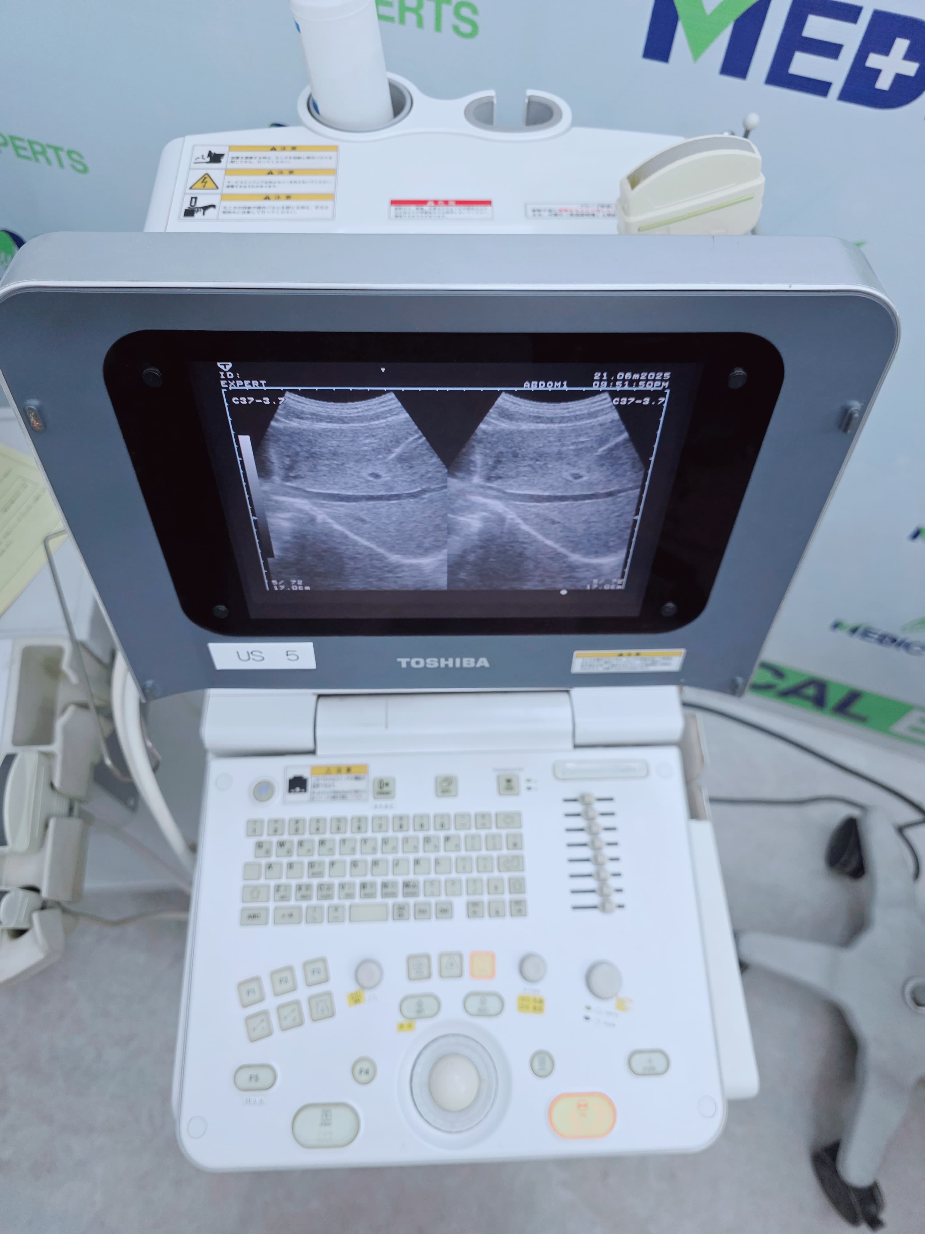 Toshiba Portable US Machine Femio Cube with Convex Probe (Local Used Mild)