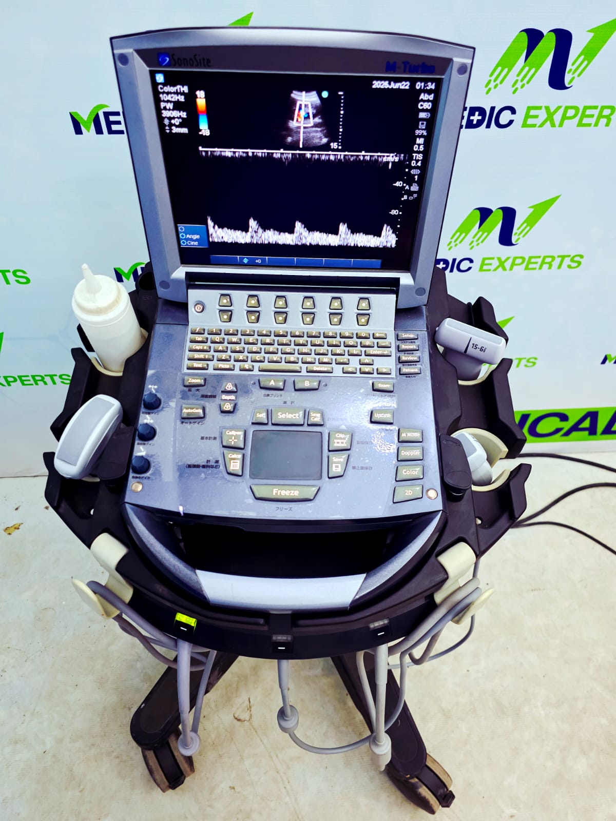 Sonosite USA M Terbo with Convex, Linear and Cardiac Probes