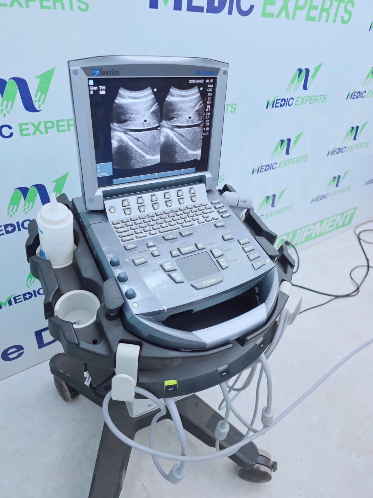Sonosite USA M Terbo with Convex, Linear and Cardiac Probes