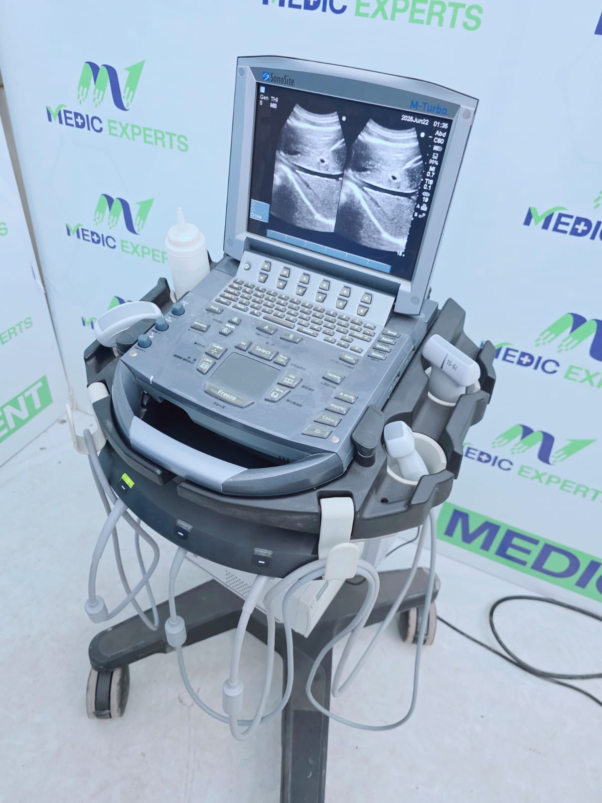 Sonosite USA M Terbo with Convex, Linear and Cardiac Probes