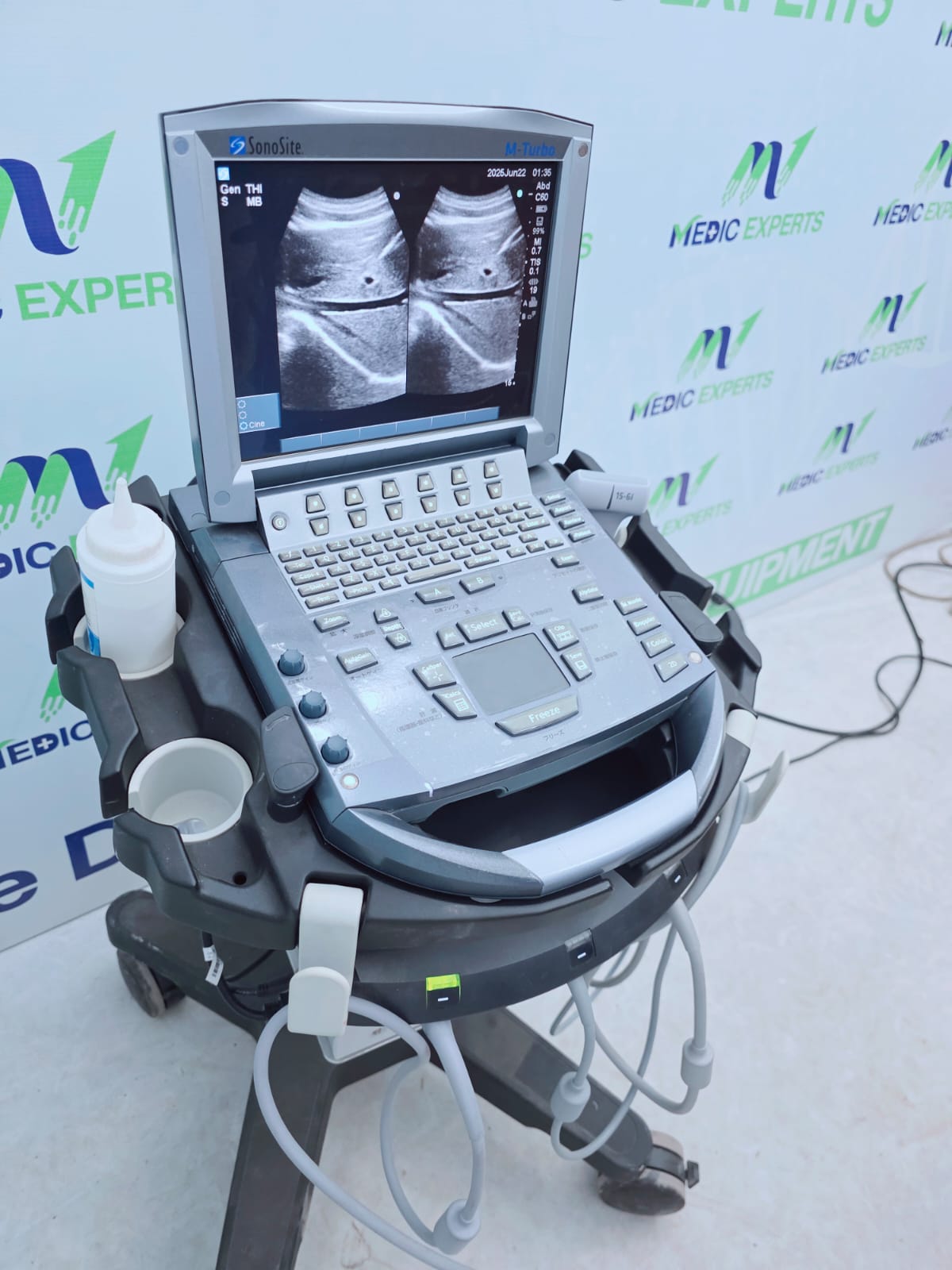 Sonosite USA M Terbo with Convex, Linear and Cardiac Probes
