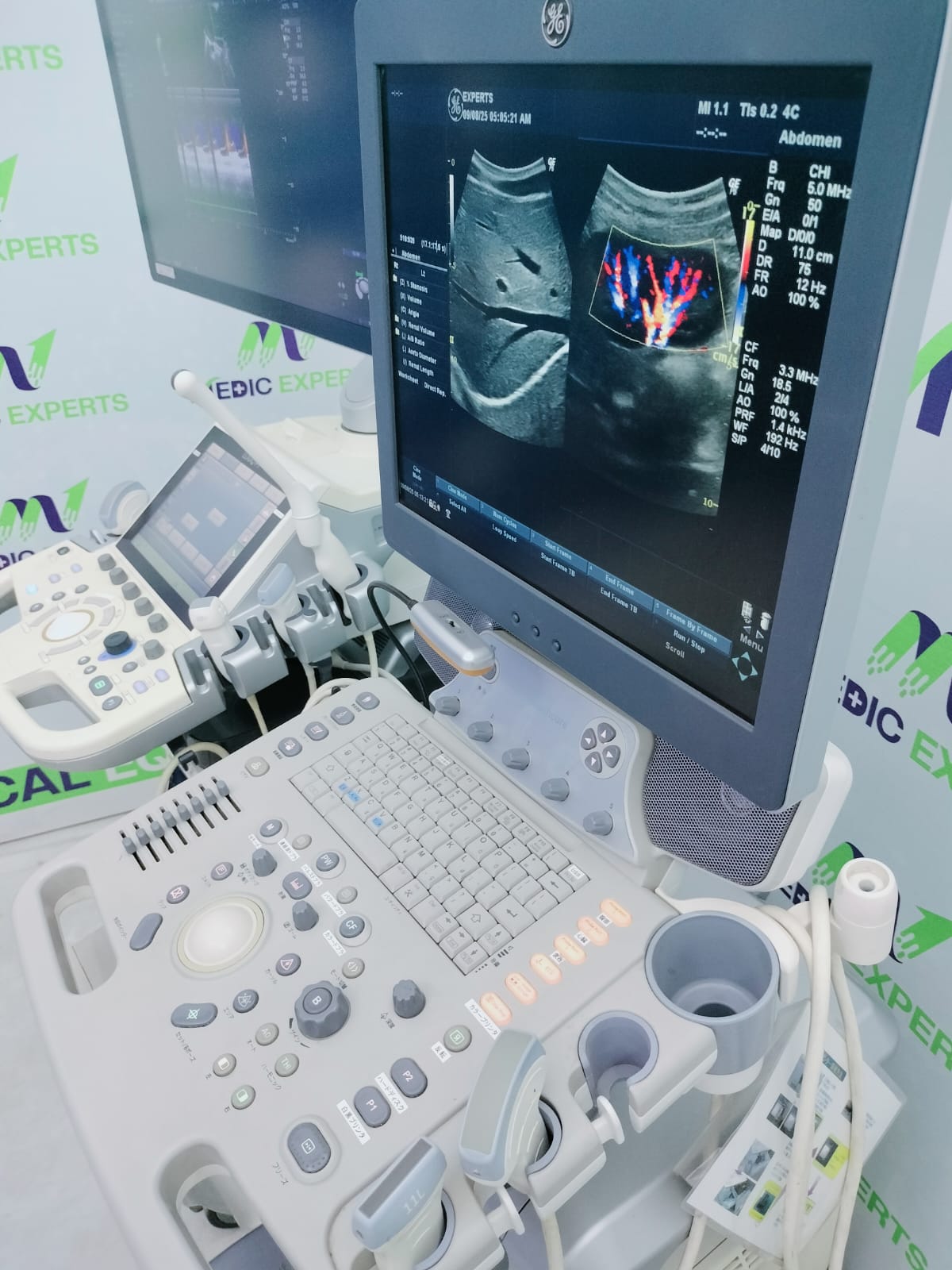 GE Logiq P6 with Convex and Linear Probes