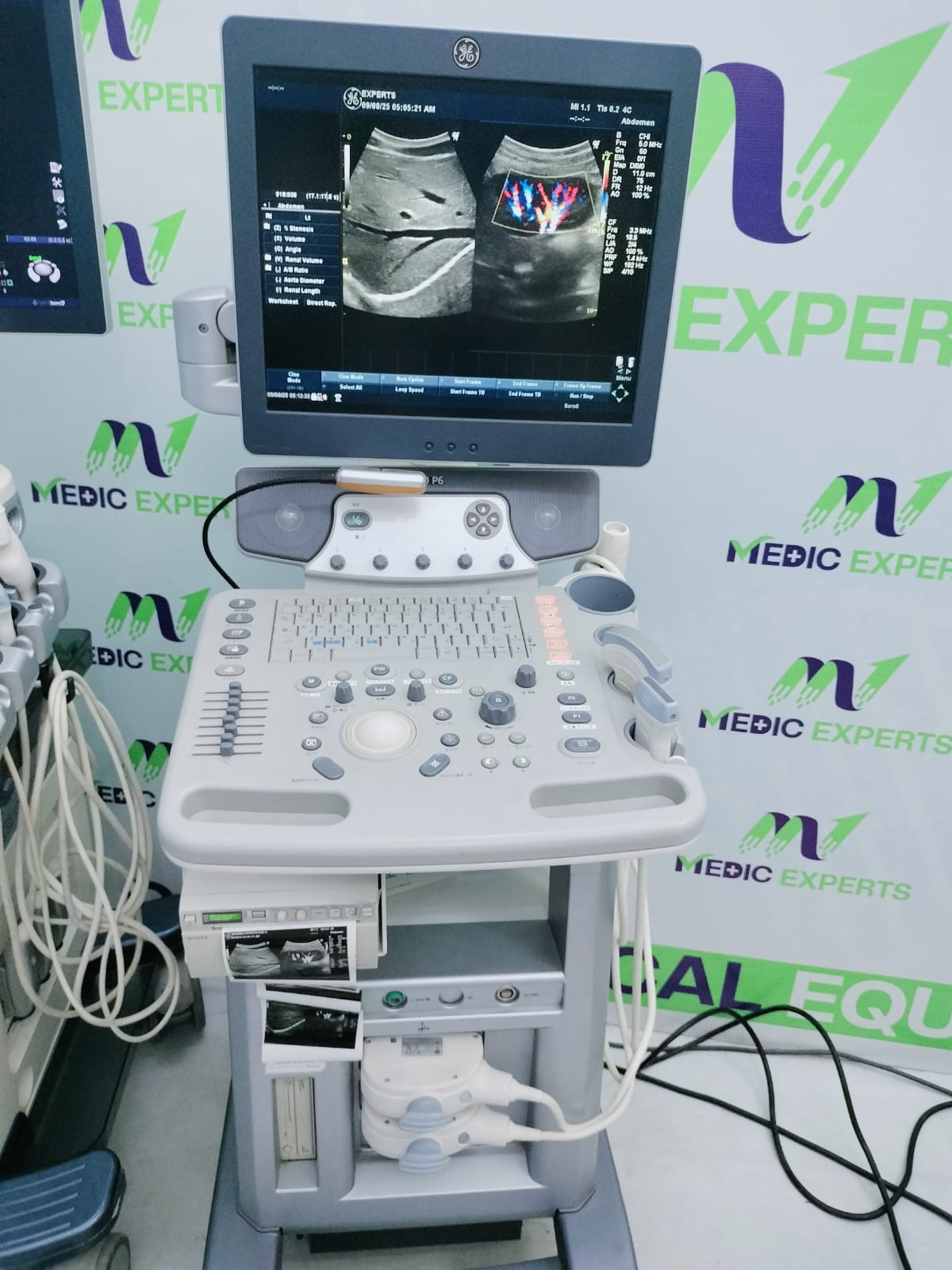 GE Logiq P6 with Convex and Linear Probes