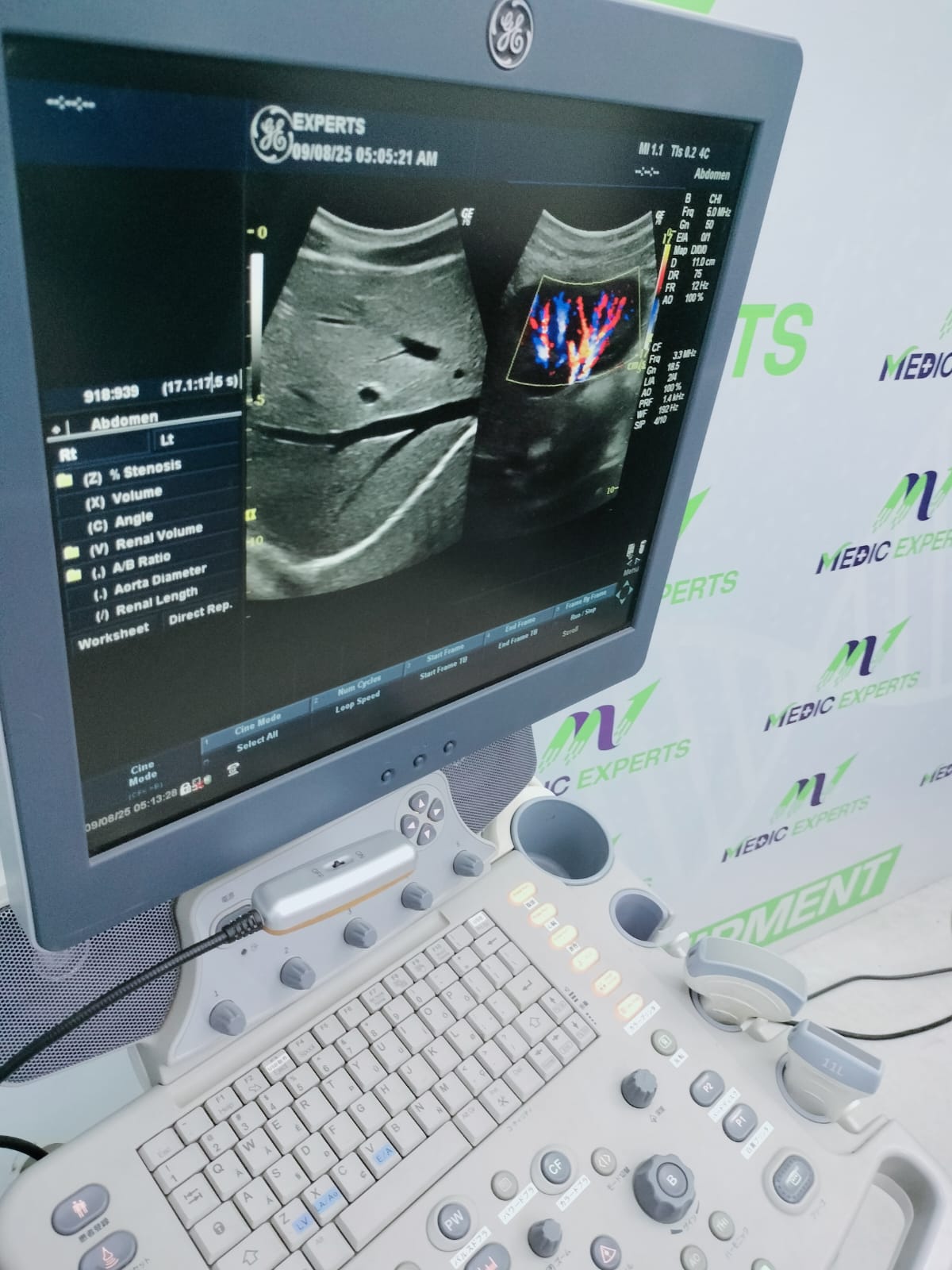 GE Logiq P6 with Convex and Linear Probes