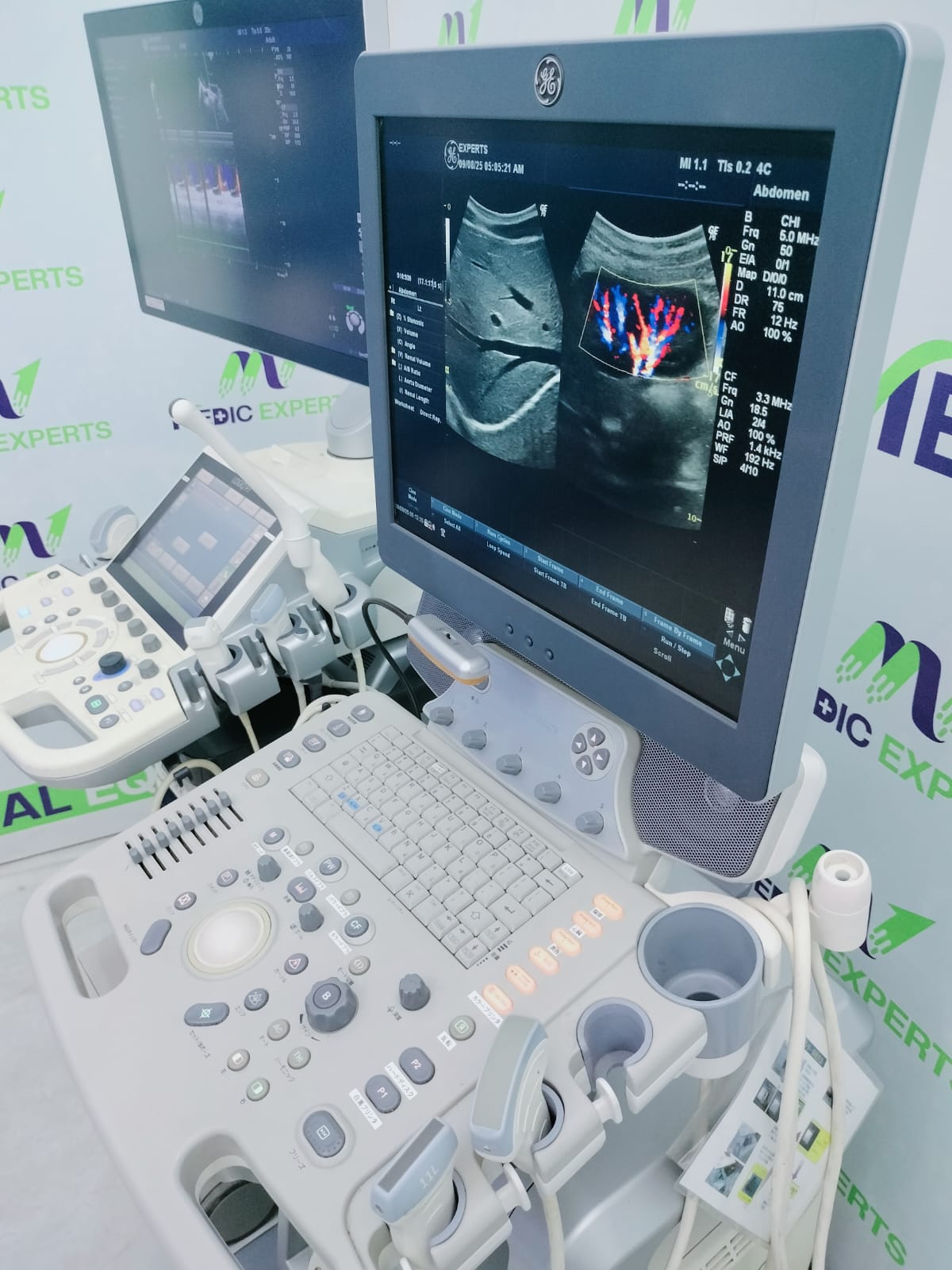 GE Logiq P6 with Convex and Linear Probes