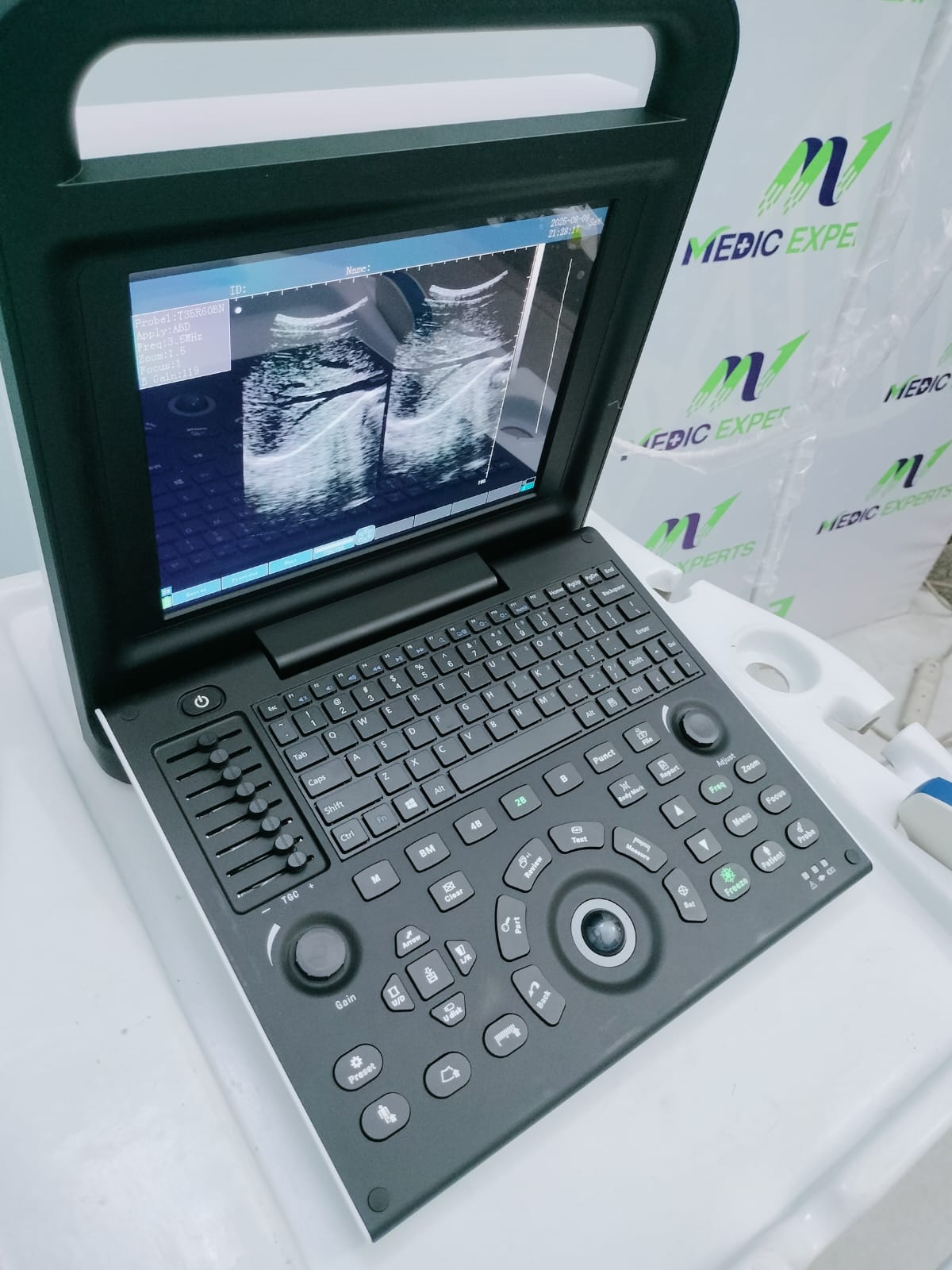 Experts 2 Portable Ultrasound System