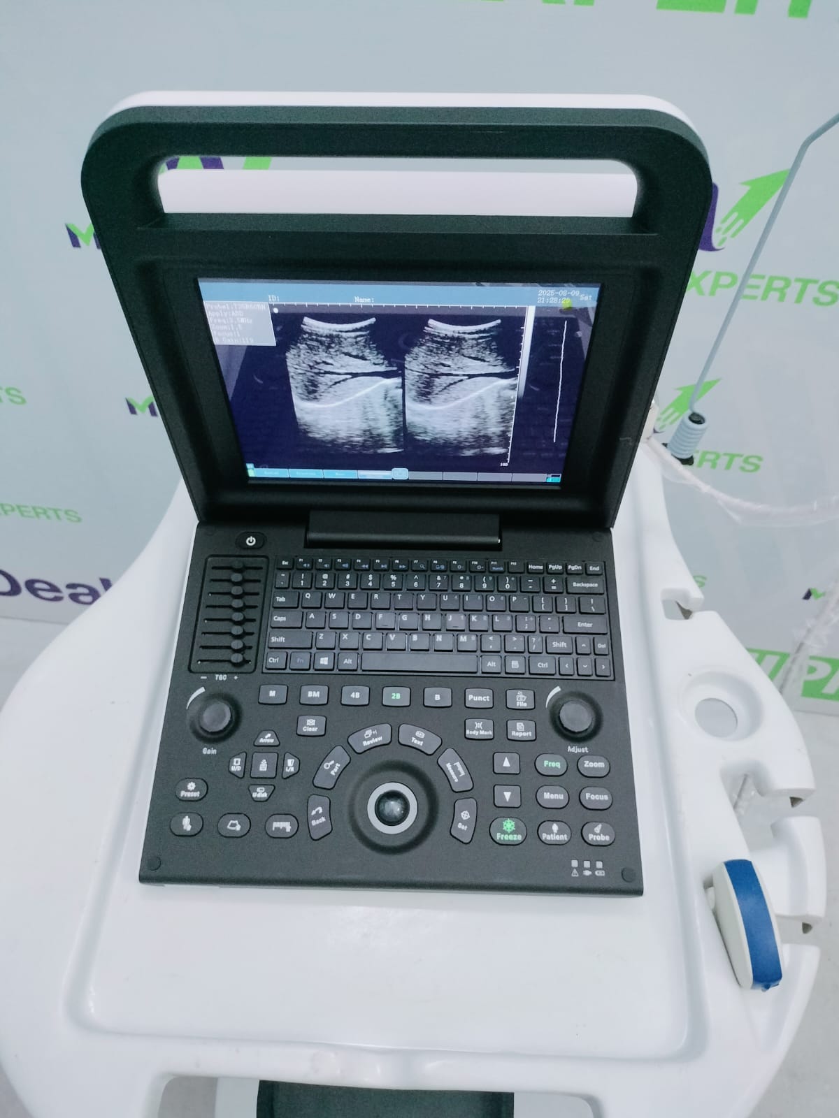 Experts 2 Portable Ultrasound System