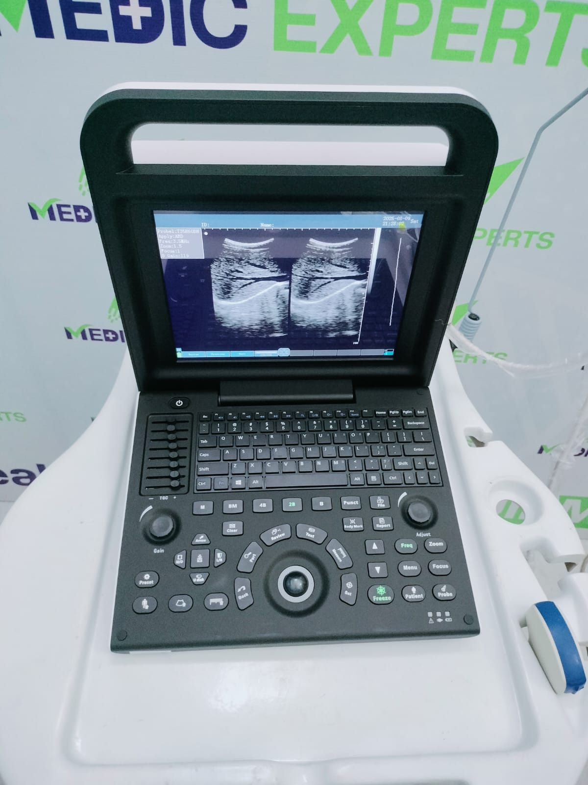 Experts 2 Portable Ultrasound System