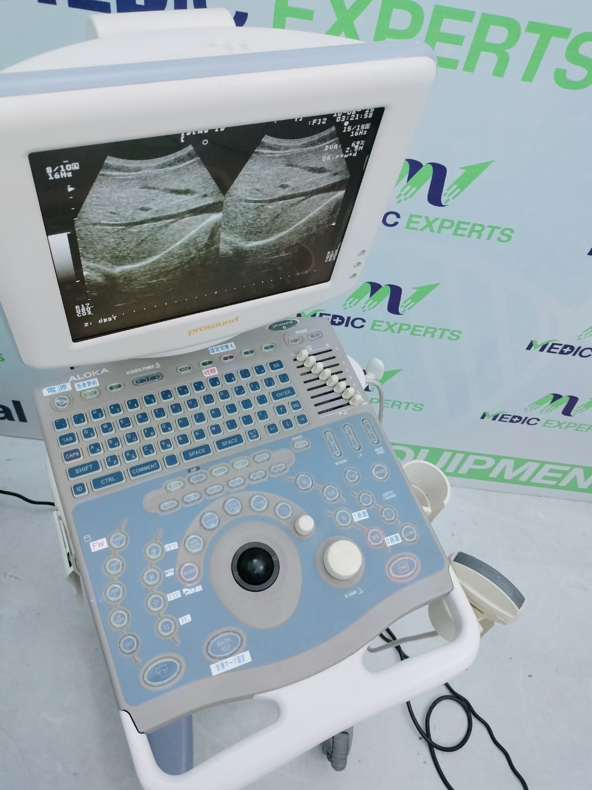 Aloka Prosound 6 with Convex Probe and Printer