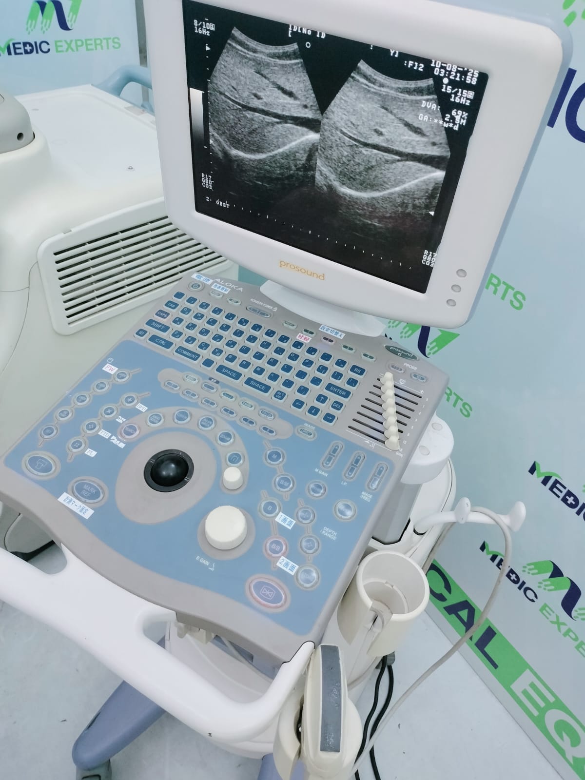 Aloka Prosound 6 with Convex Probe and Printer