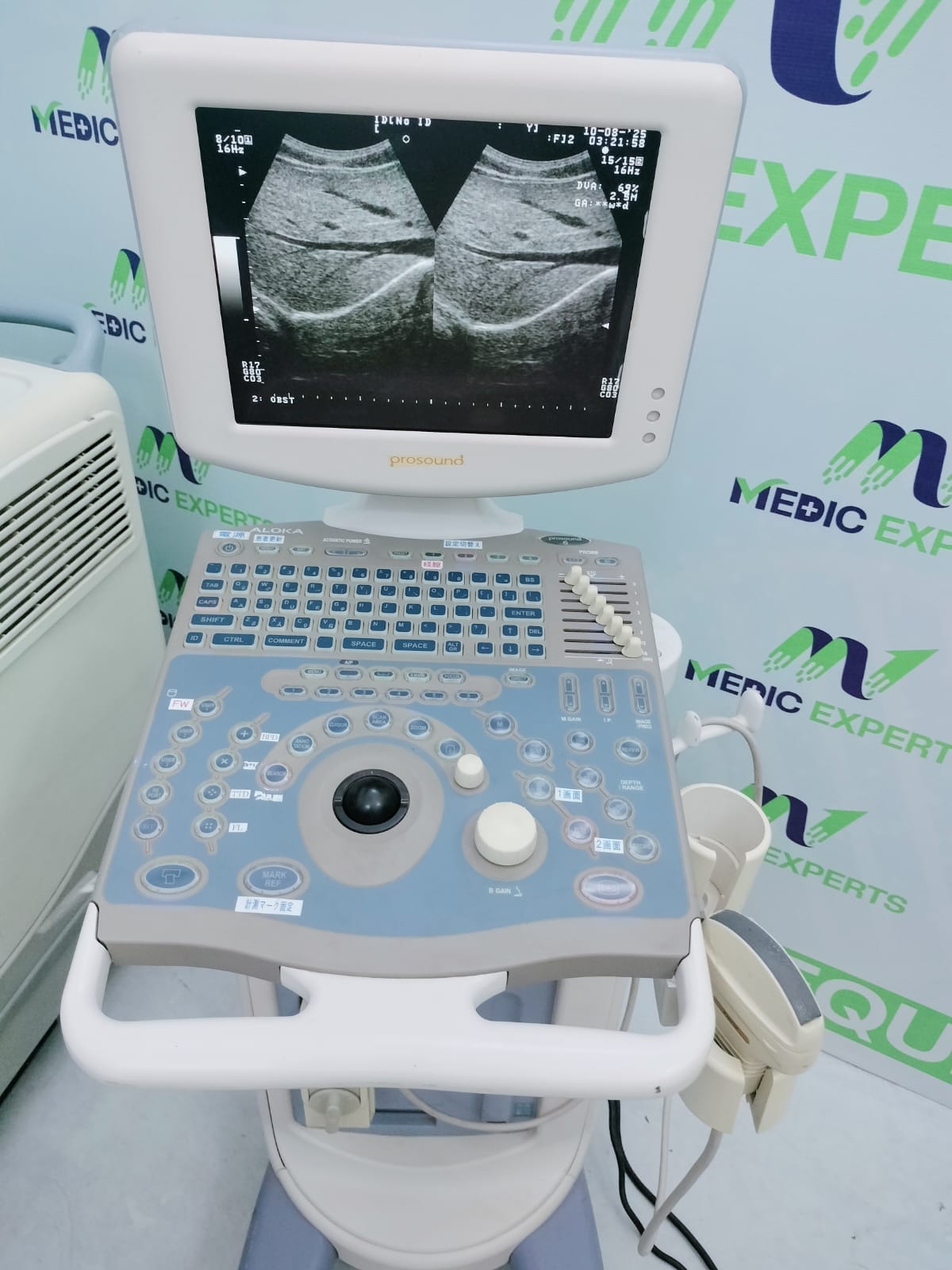 Aloka Prosound 6 with Convex Probe and Printer