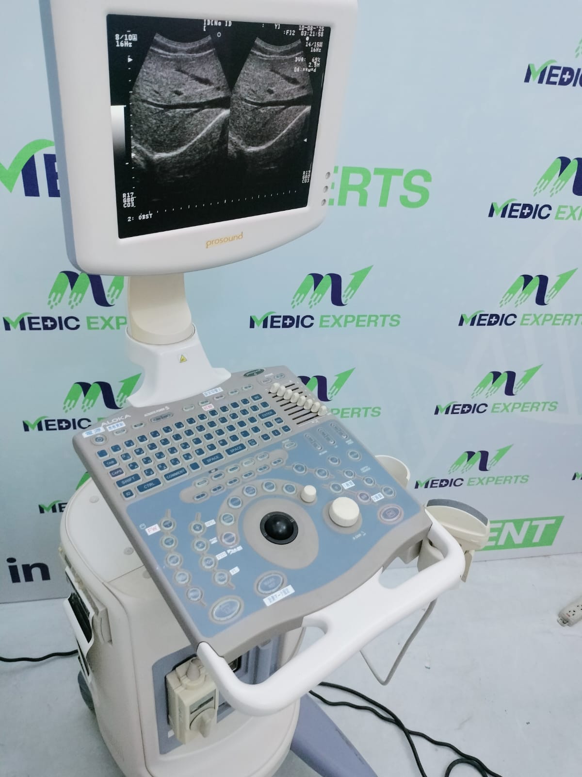 Aloka Prosound 6 with Convex Probe and Printer