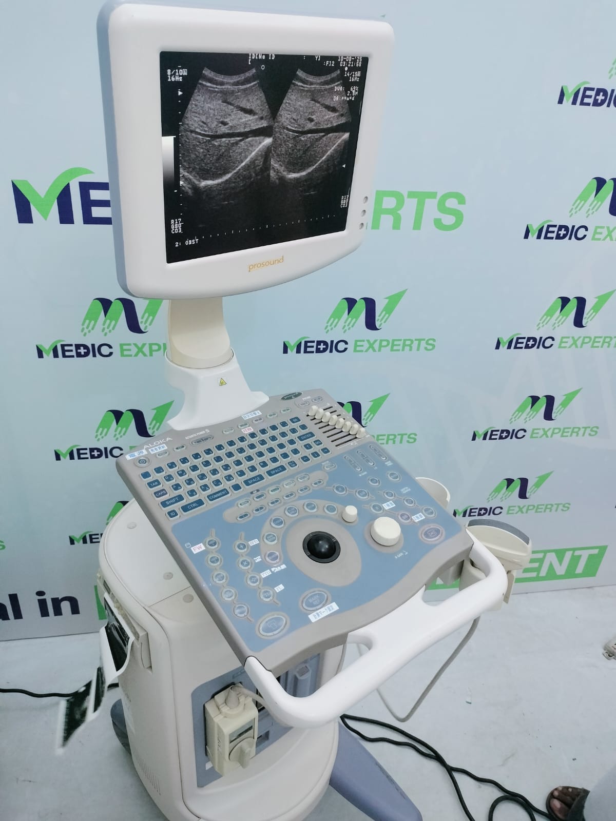 Aloka Prosound 6 with Convex Probe and Printer