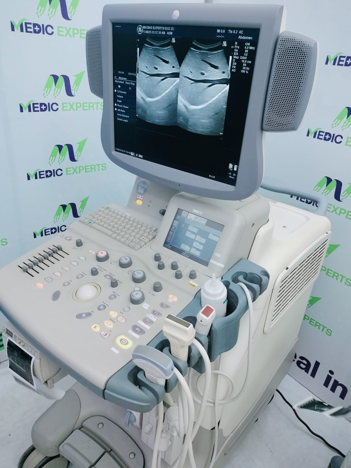 GE Logiq S6 with Convex and Linear Probes Cardiac board plus CW Active 