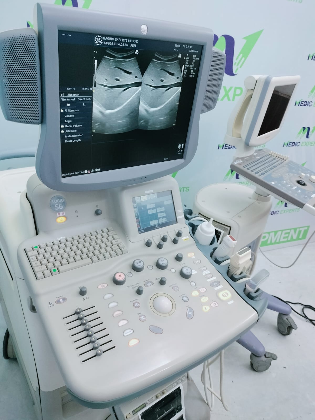 GE Logiq S6 with Convex and Linear Probes Cardiac board plus CW Active 