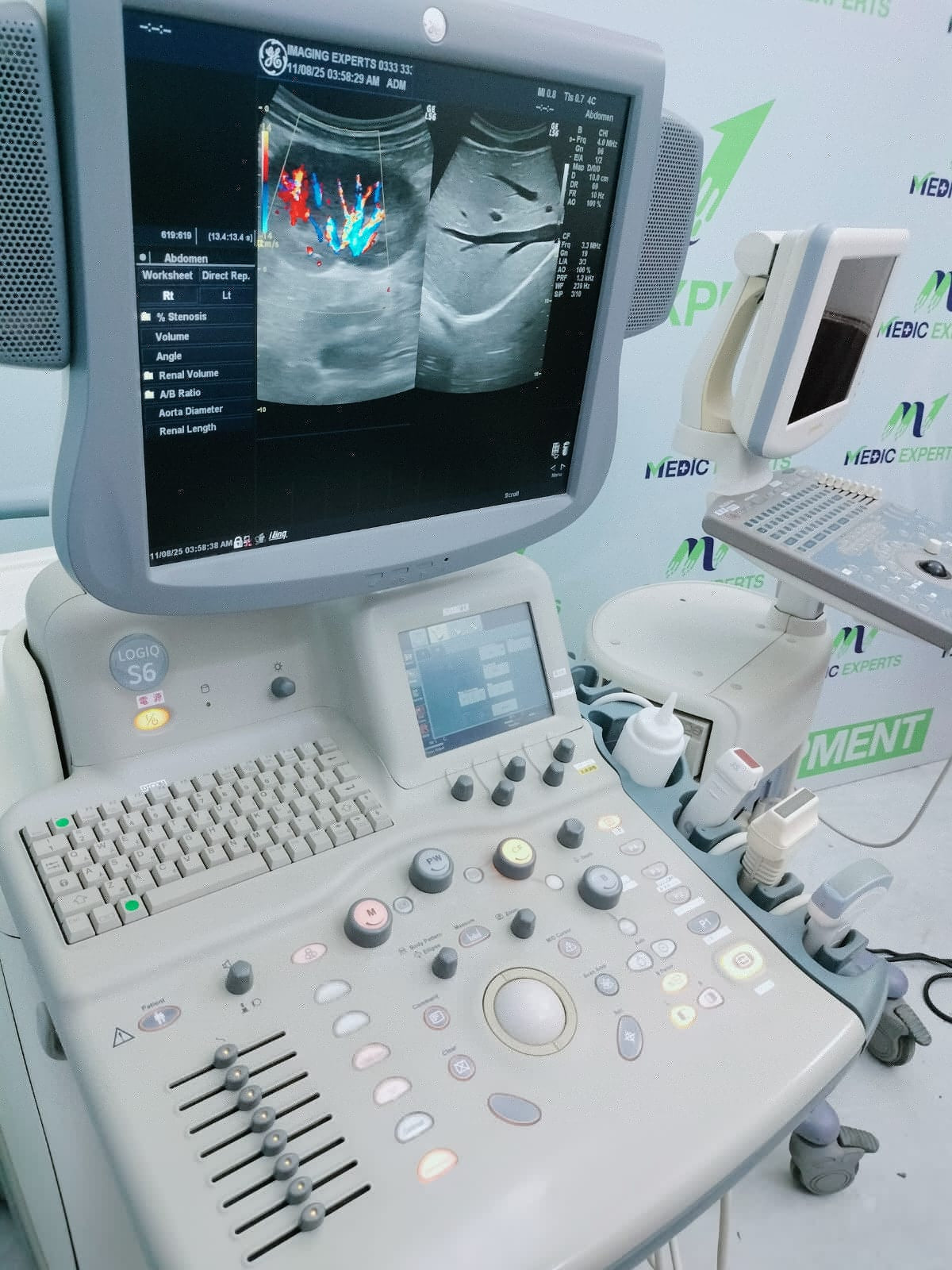 GE Logiq S6 with Convex and Linear Probes Cardiac board plus CW Active 